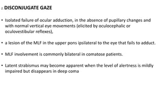 2. DISCONJUGATE GAZE
• Isolated failure of ocular adduction, in the absence of pupillary changes and
with normal vertical eye movements (elicited by oculocephalic or
oculovestibular reflexes),
• a lesion of the MLF in the upper pons ipsilateral to the eye that fails to adduct.
• MLF involvement is commonly bilateral in comatose patients.
• Latent strabismus may become apparent when the level of alertness is mildly
impaired but disappears in deep coma
 