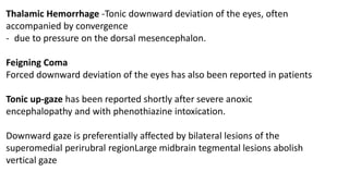Thalamic Hemorrhage -Tonic downward deviation of the eyes, often
accompanied by convergence
- due to pressure on the dorsal mesencephalon.
Feigning Coma
Forced downward deviation of the eyes has also been reported in patients
Tonic up-gaze has been reported shortly after severe anoxic
encephalopathy and with phenothiazine intoxication.
Downward gaze is preferentially affected by bilateral lesions of the
superomedial perirubral regionLarge midbrain tegmental lesions abolish
vertical gaze
 