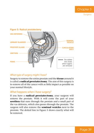 Page 39
Chapter 3
Surgery
Figure 5: Radical prostatectomy
What type of surgery might I have?
Surgery to remove the entire ...
