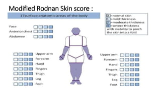 Rodnan Skin LOCALISED SCLERODERMA.pptx