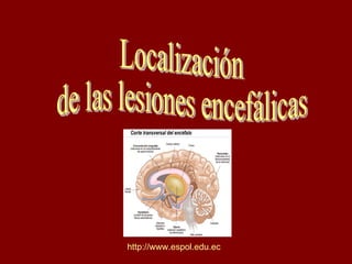 Localización  de las lesiones encefálicas http://www.espol.edu.ec 