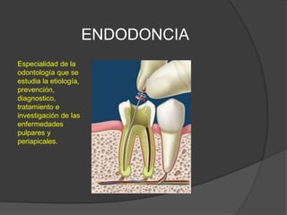 ENDODONCIA
Especialidad de la
odontología que se
estudia la etiología,
prevención,
diagnostico,
tratamiento e
investigación de las
enfermedades
pulpares y
periapicales.
 