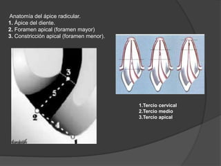 Anatomía del ápice radicular.
1. Ápice del diente.
2. Foramen apical (foramen mayor)
3. Constricción apical (foramen menor).




                                          1.Tercio cervical
                                          2.Tercio medio
                                          3.Tercio apical
 