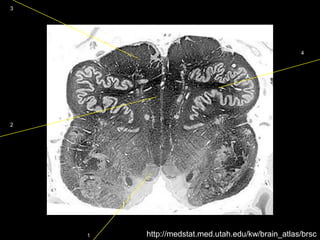 localization-imaging-lecture-2.pdf interpretation | PDF