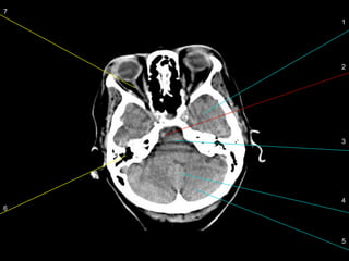 localization-imaging-lecture-2.pdf interpretation | PDF