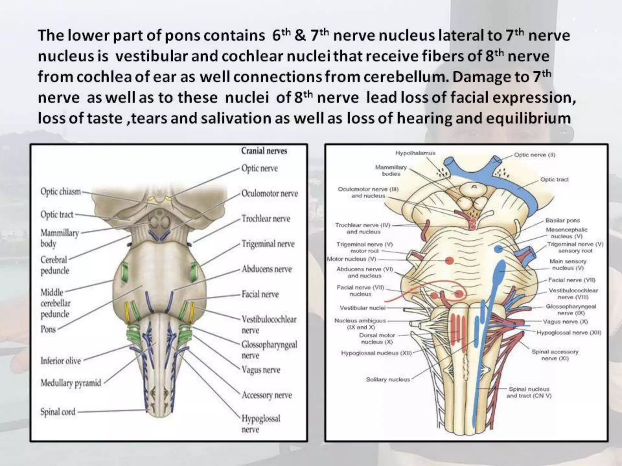 Localization of brainstem lesion by Prof Dr Bashir Ahmed Dar Sopore Kashmir