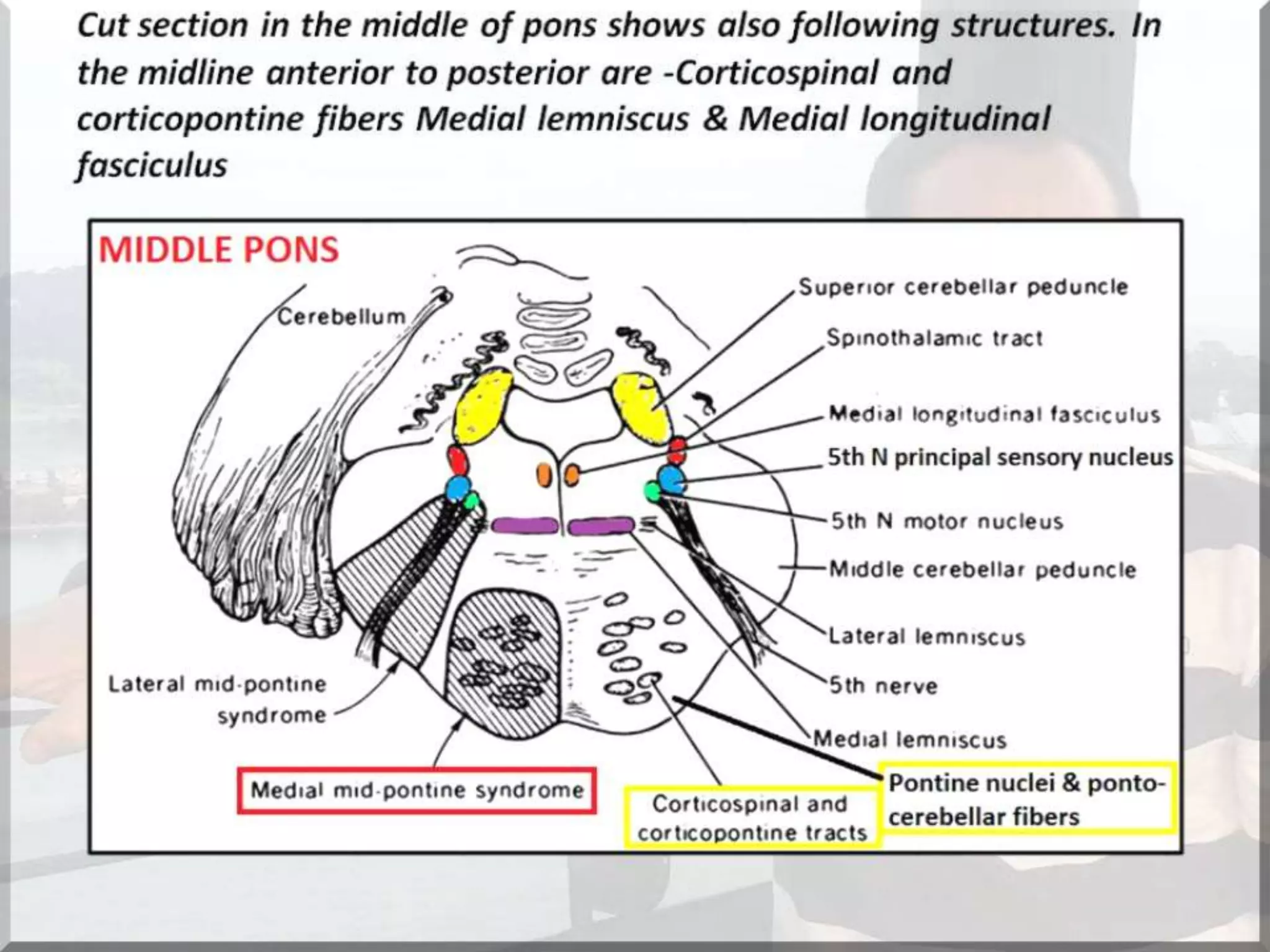 Localization of brainstem lesion by Prof Dr Bashir Ahmed Dar Sopore Kashmir