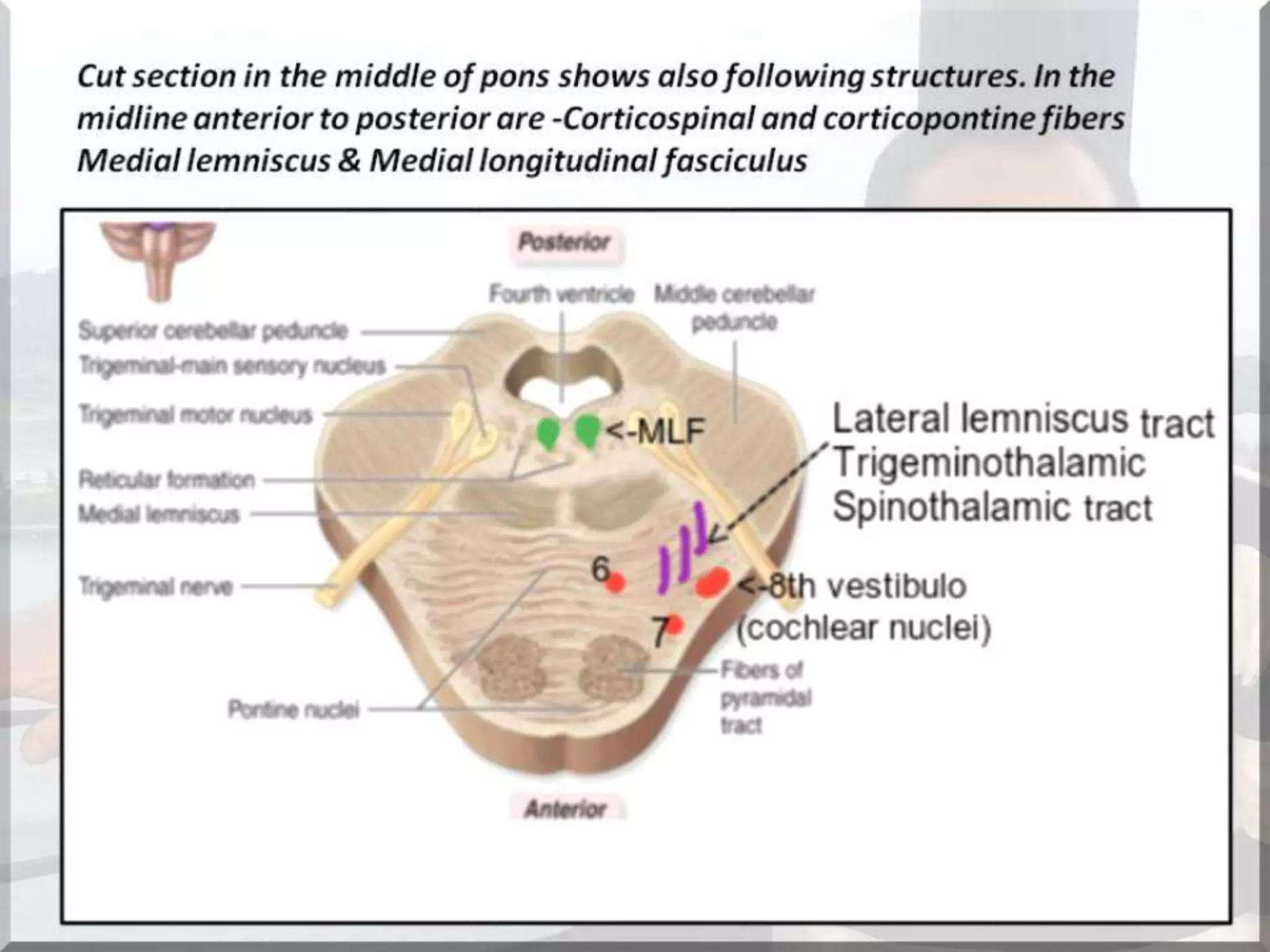 Localization of brainstem lesion by Prof Dr Bashir Ahmed Dar Sopore Kashmir