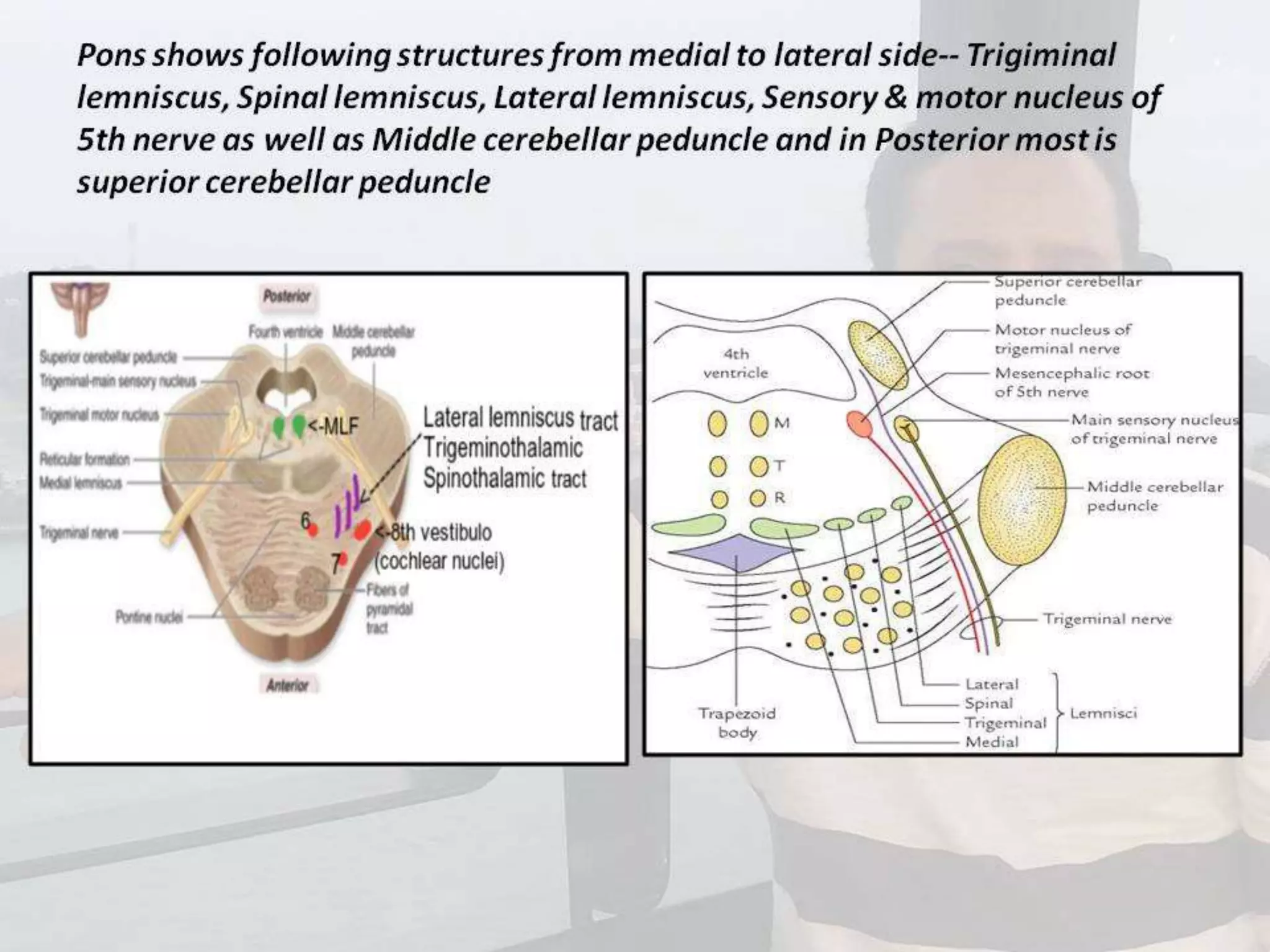 Localization of brainstem lesion by Prof Dr Bashir Ahmed Dar Sopore Kashmir