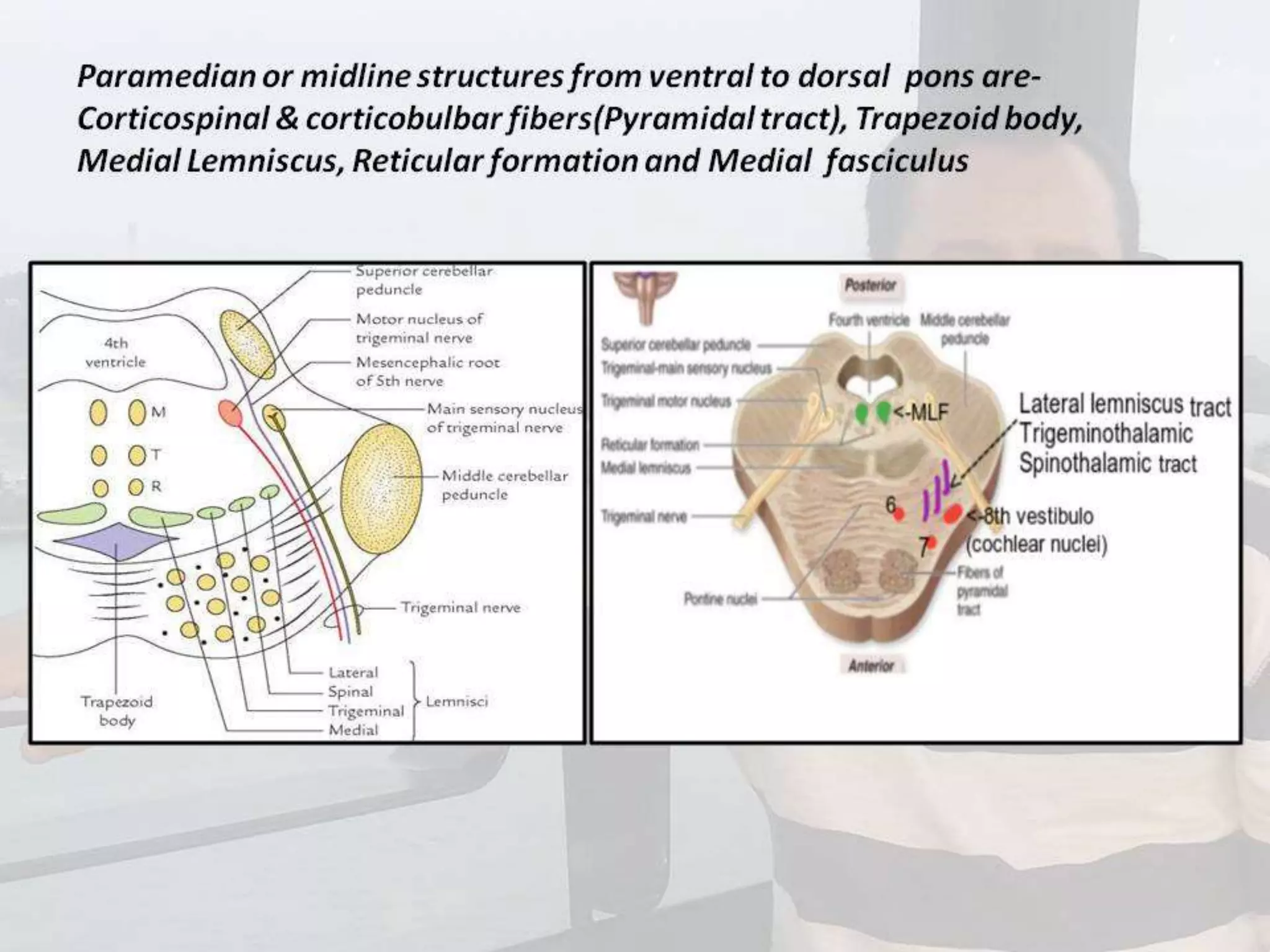 Localization of brainstem lesion by Prof Dr Bashir Ahmed Dar Sopore Kashmir