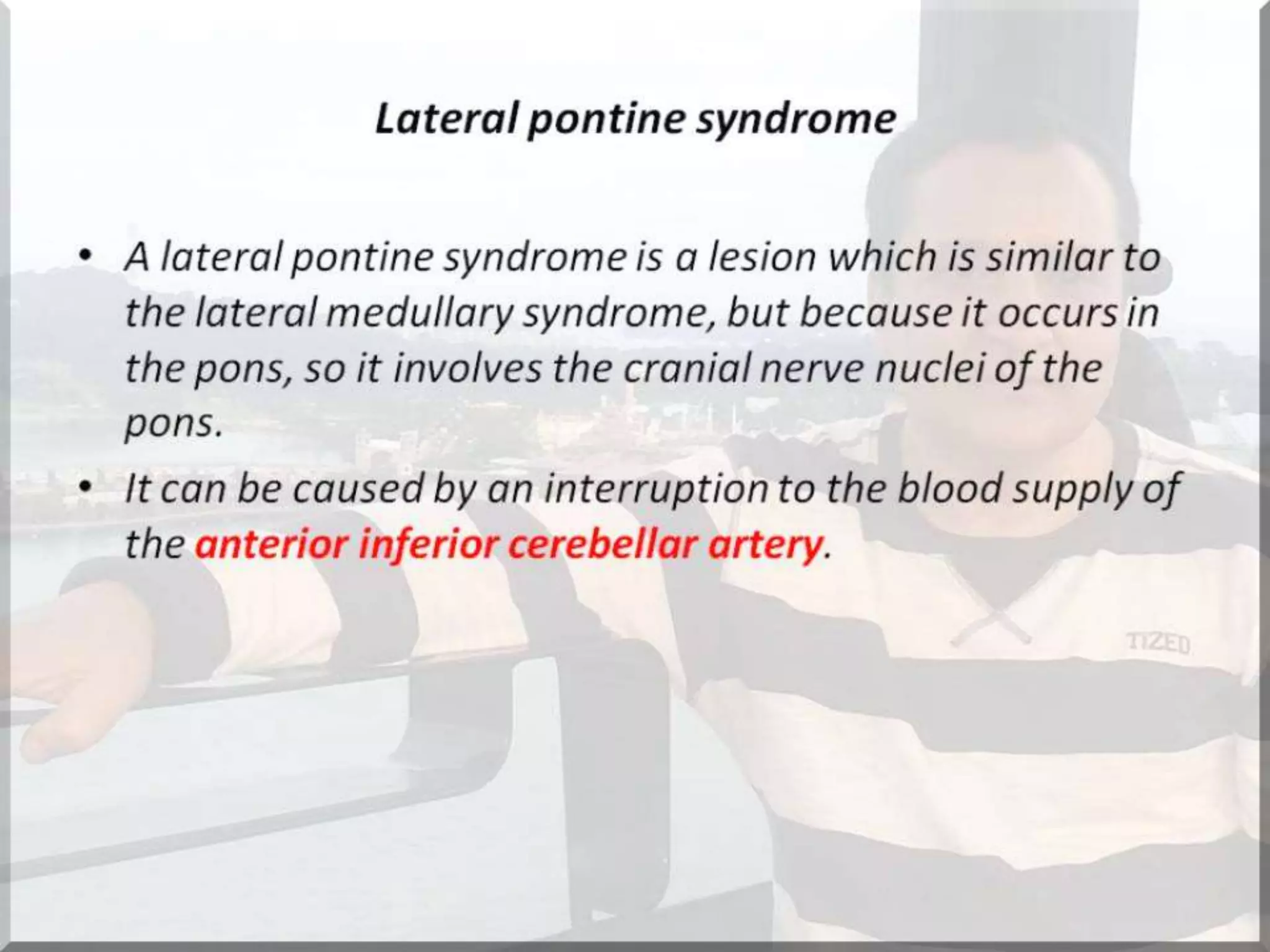 Localization of brainstem lesion by Prof Dr Bashir Ahmed Dar Sopore Kashmir