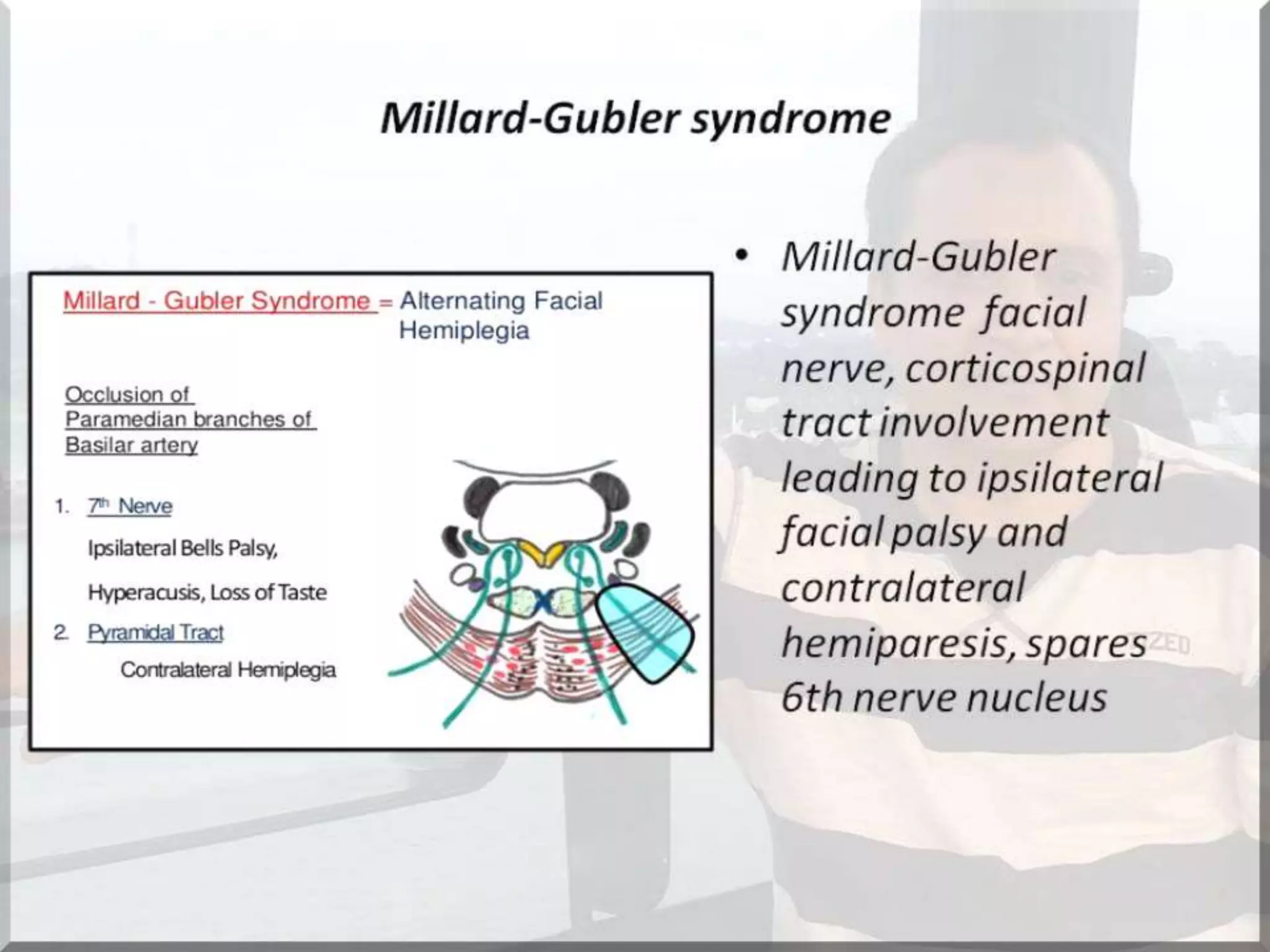 Localization of brainstem lesion by Prof Dr Bashir Ahmed Dar Sopore Kashmir