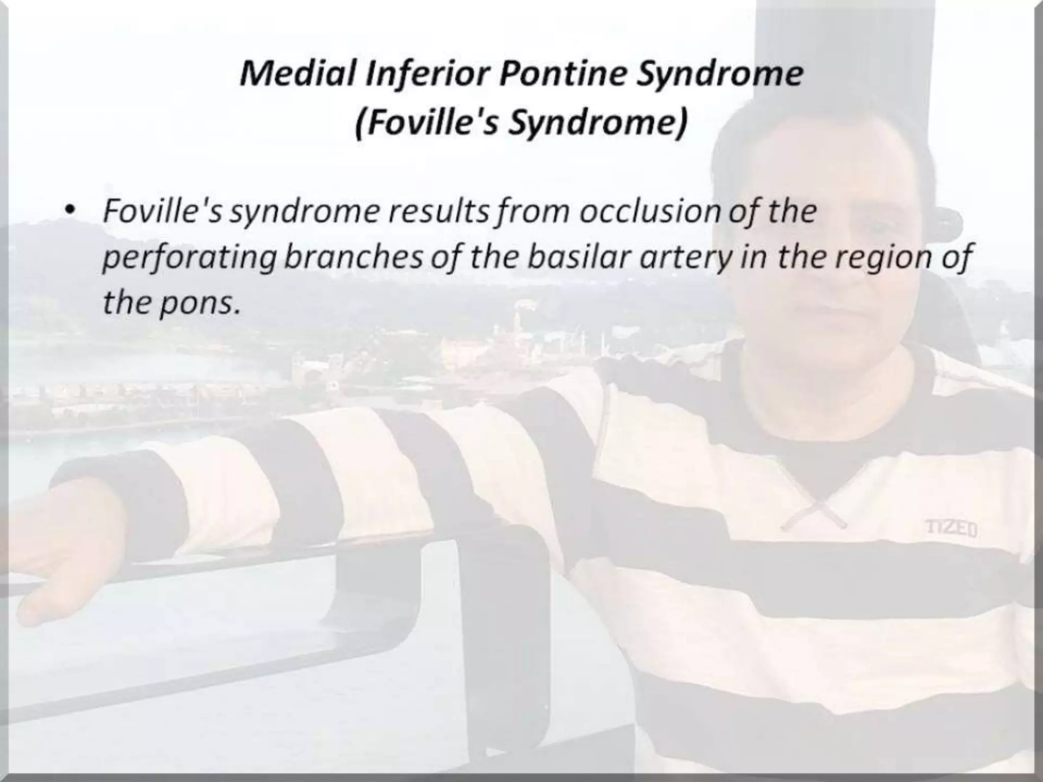 Localization of brainstem lesion by Prof Dr Bashir Ahmed Dar Sopore Kashmir