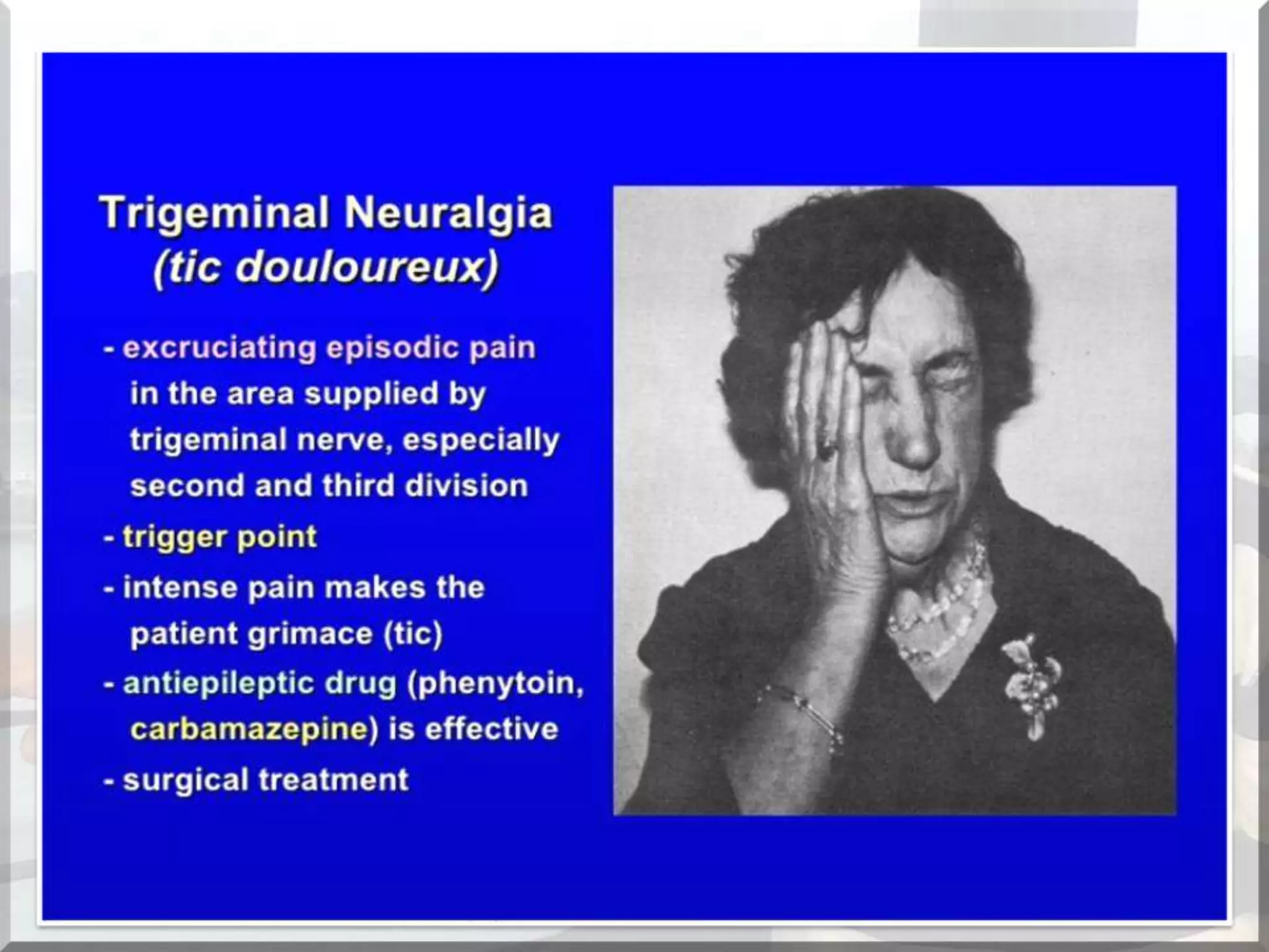 Localization of brainstem lesion by Prof Dr Bashir Ahmed Dar Sopore Kashmir
