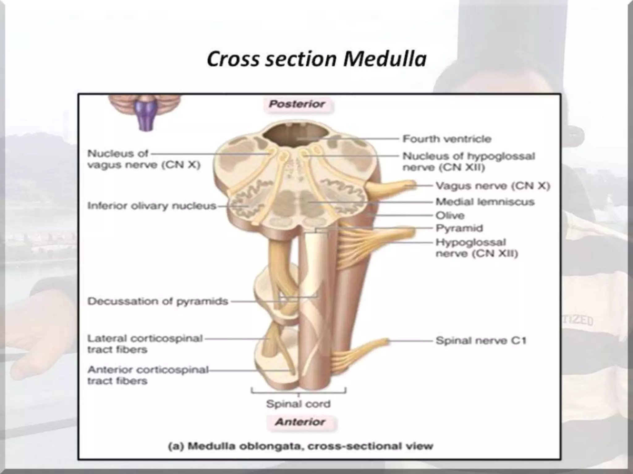 Localization of brainstem lesion by Prof Dr Bashir Ahmed Dar Sopore Kashmir