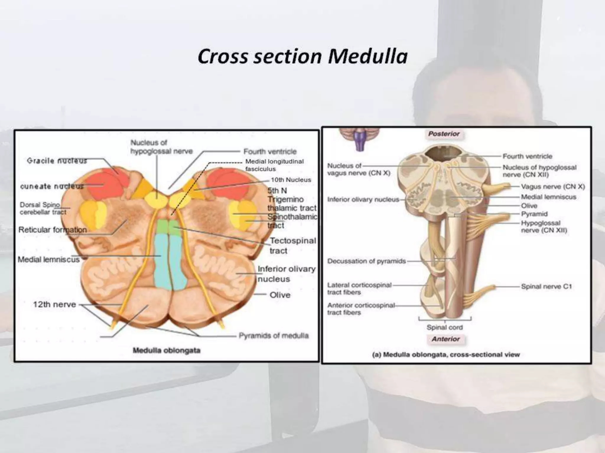 Localization of brainstem lesion by Prof Dr Bashir Ahmed Dar Sopore Kashmir