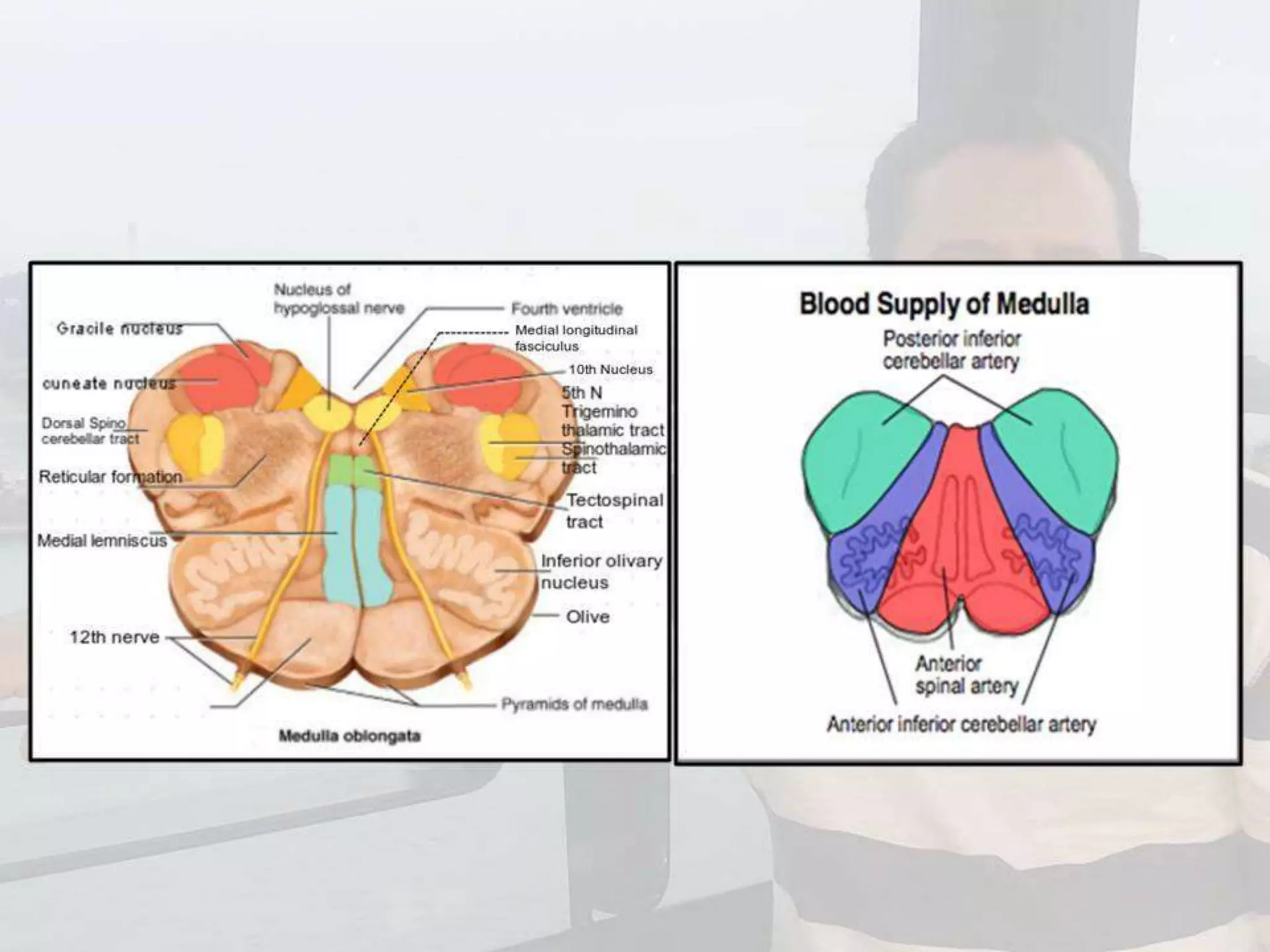 Localization of brainstem lesion by Prof Dr Bashir Ahmed Dar Sopore Kashmir