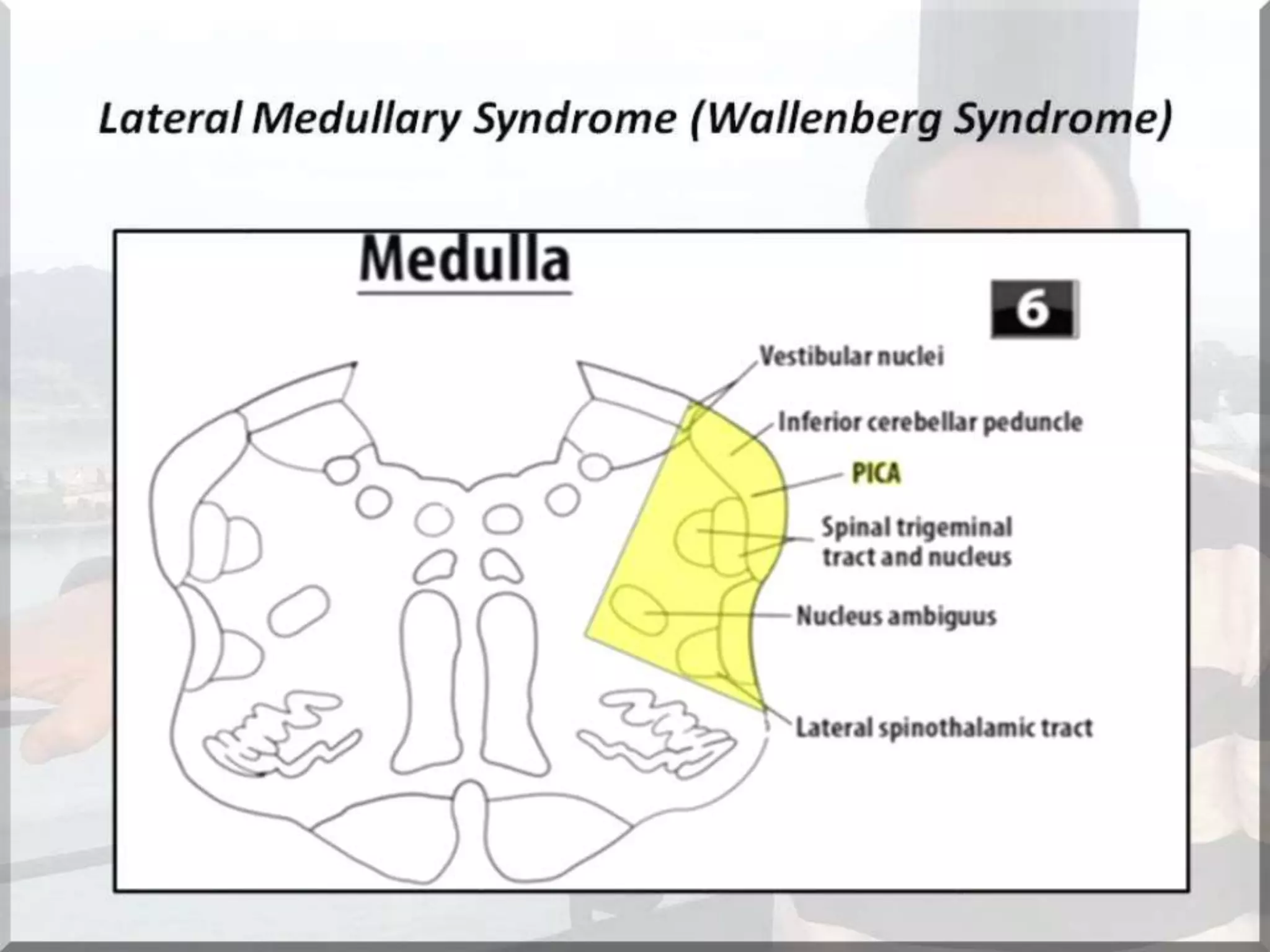 Localization of brainstem lesion by Prof Dr Bashir Ahmed Dar Sopore Kashmir