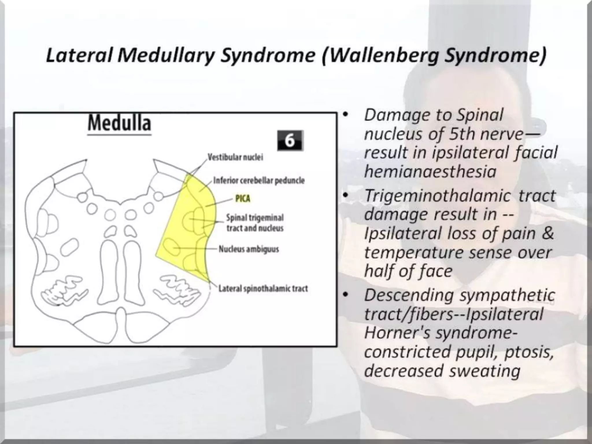 Localization of brainstem lesion by Prof Dr Bashir Ahmed Dar Sopore Kashmir