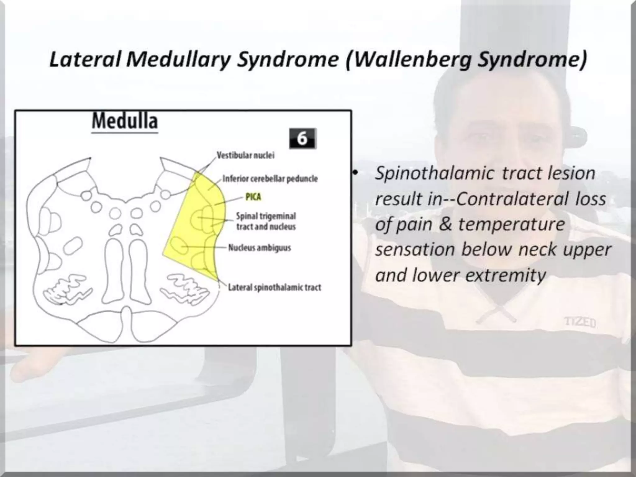 Localization of brainstem lesion by Prof Dr Bashir Ahmed Dar Sopore Kashmir