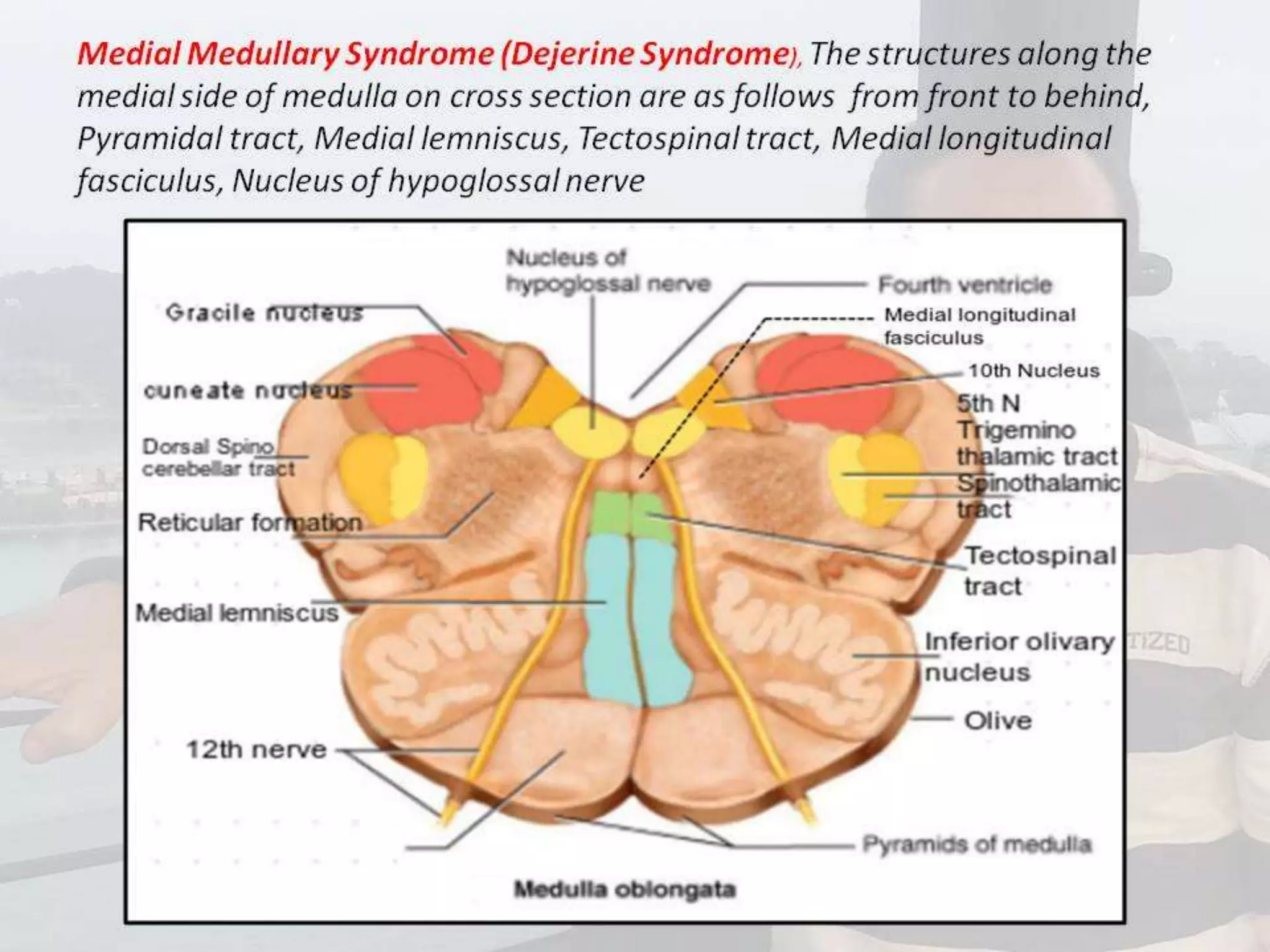 Localization of brainstem lesion by Prof Dr Bashir Ahmed Dar Sopore Kashmir
