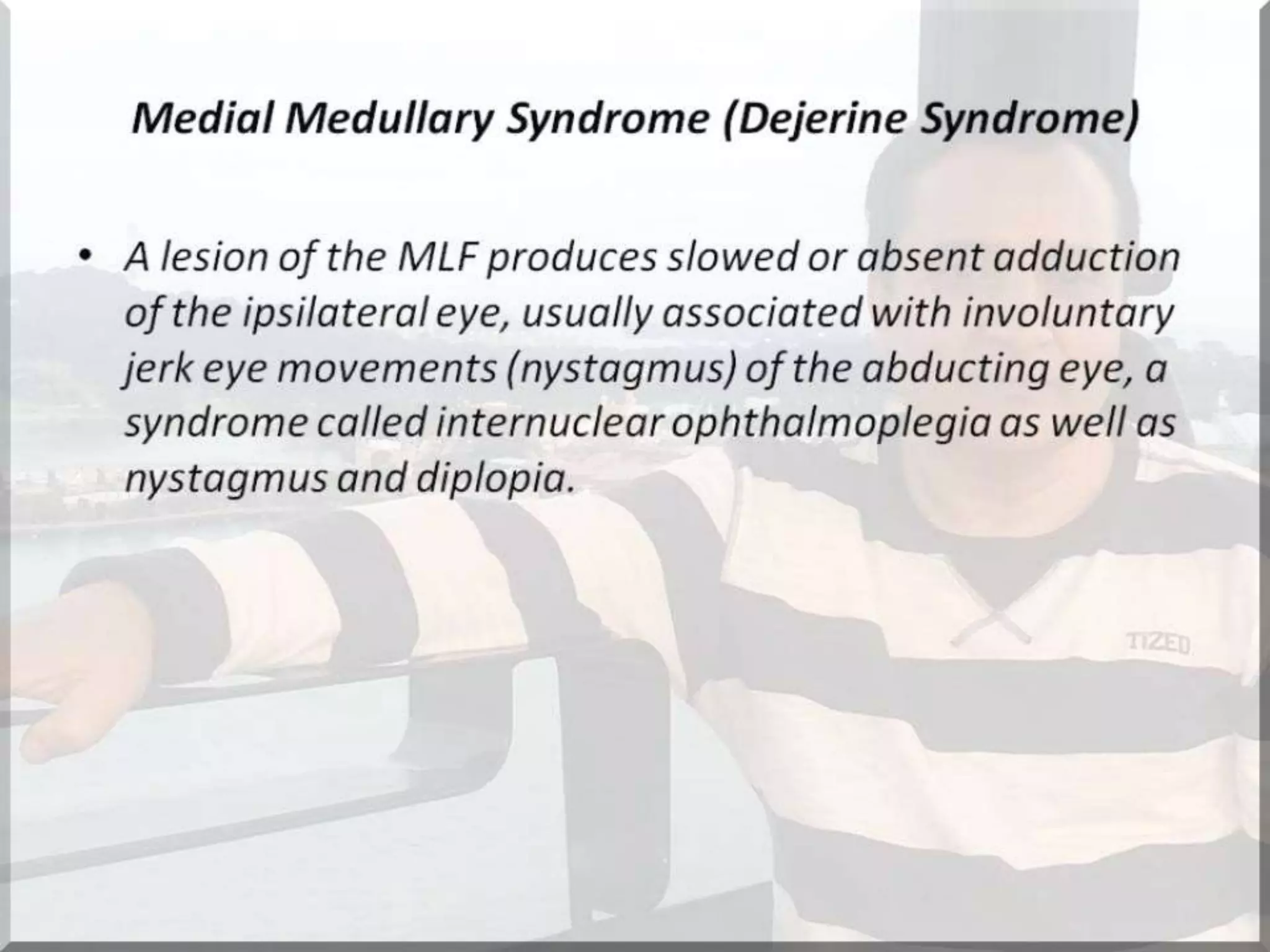 Localization of brainstem lesion by Prof Dr Bashir Ahmed Dar Sopore Kashmir