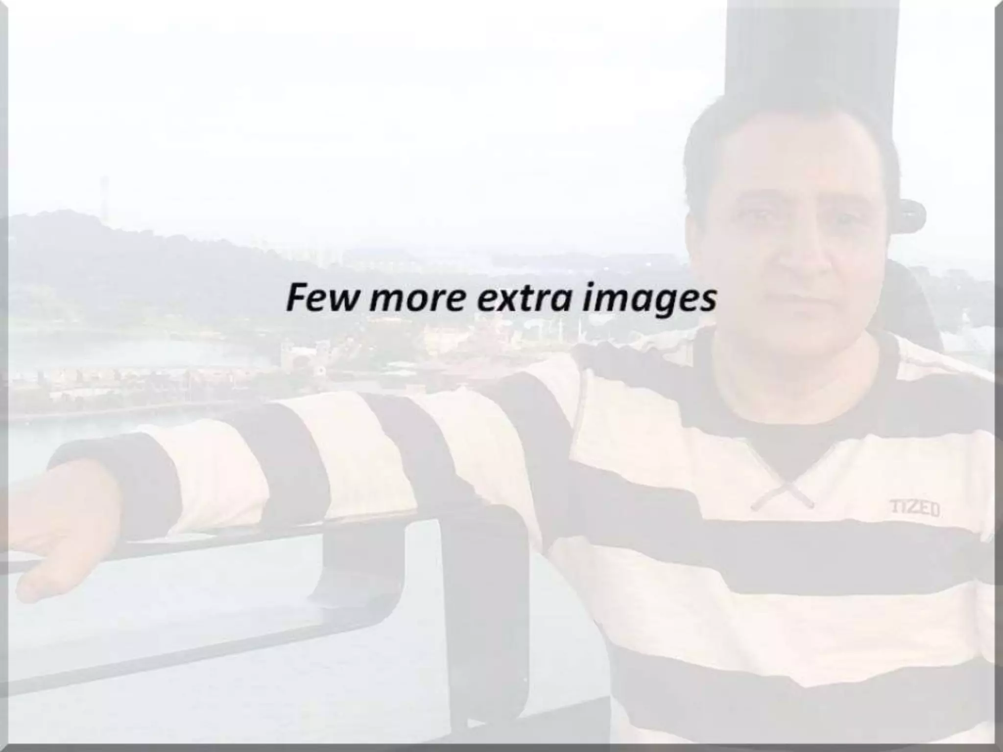 Localization of brainstem lesion by Prof Dr Bashir Ahmed Dar Sopore Kashmir