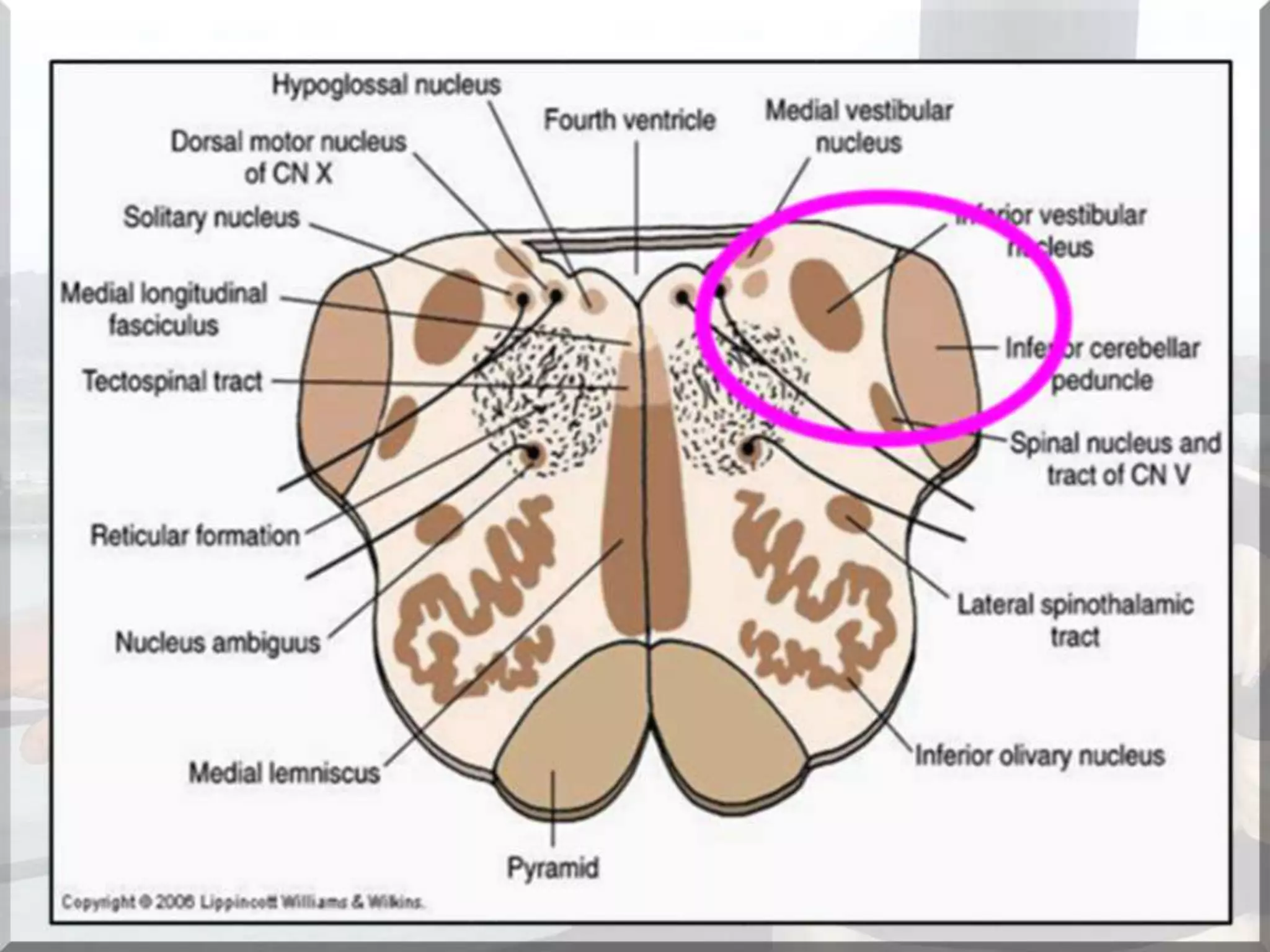 Localization of brainstem lesion by Prof Dr Bashir Ahmed Dar Sopore Kashmir
