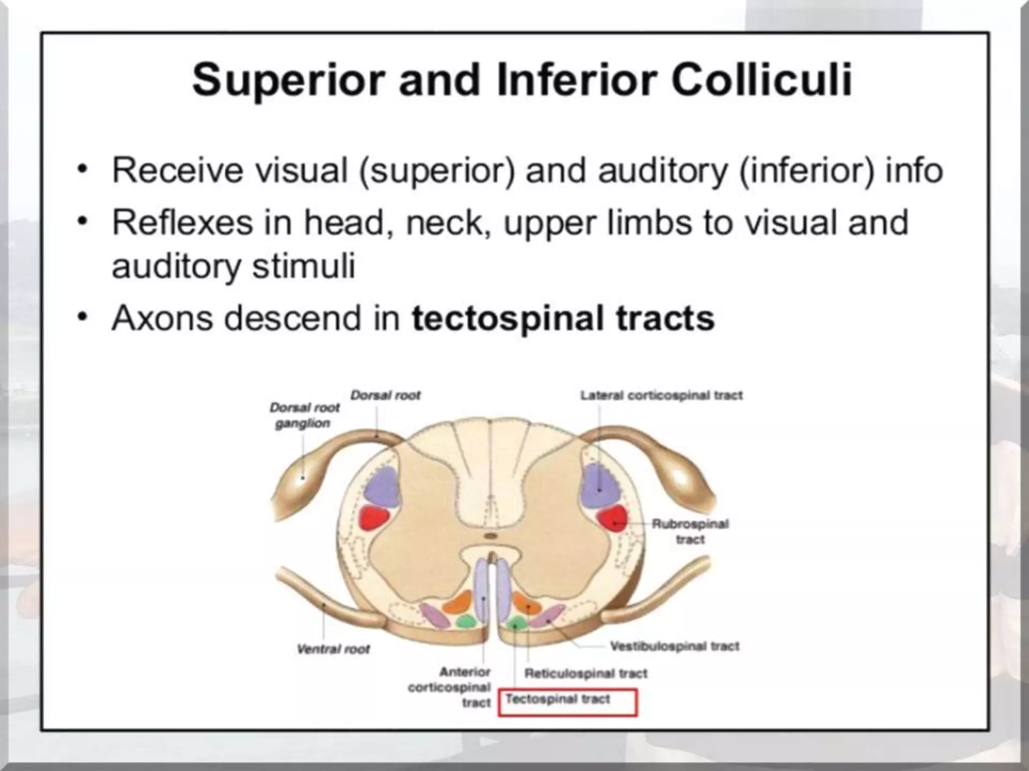 Localization of brainstem lesion by Prof Dr Bashir Ahmed Dar Sopore Kashmir