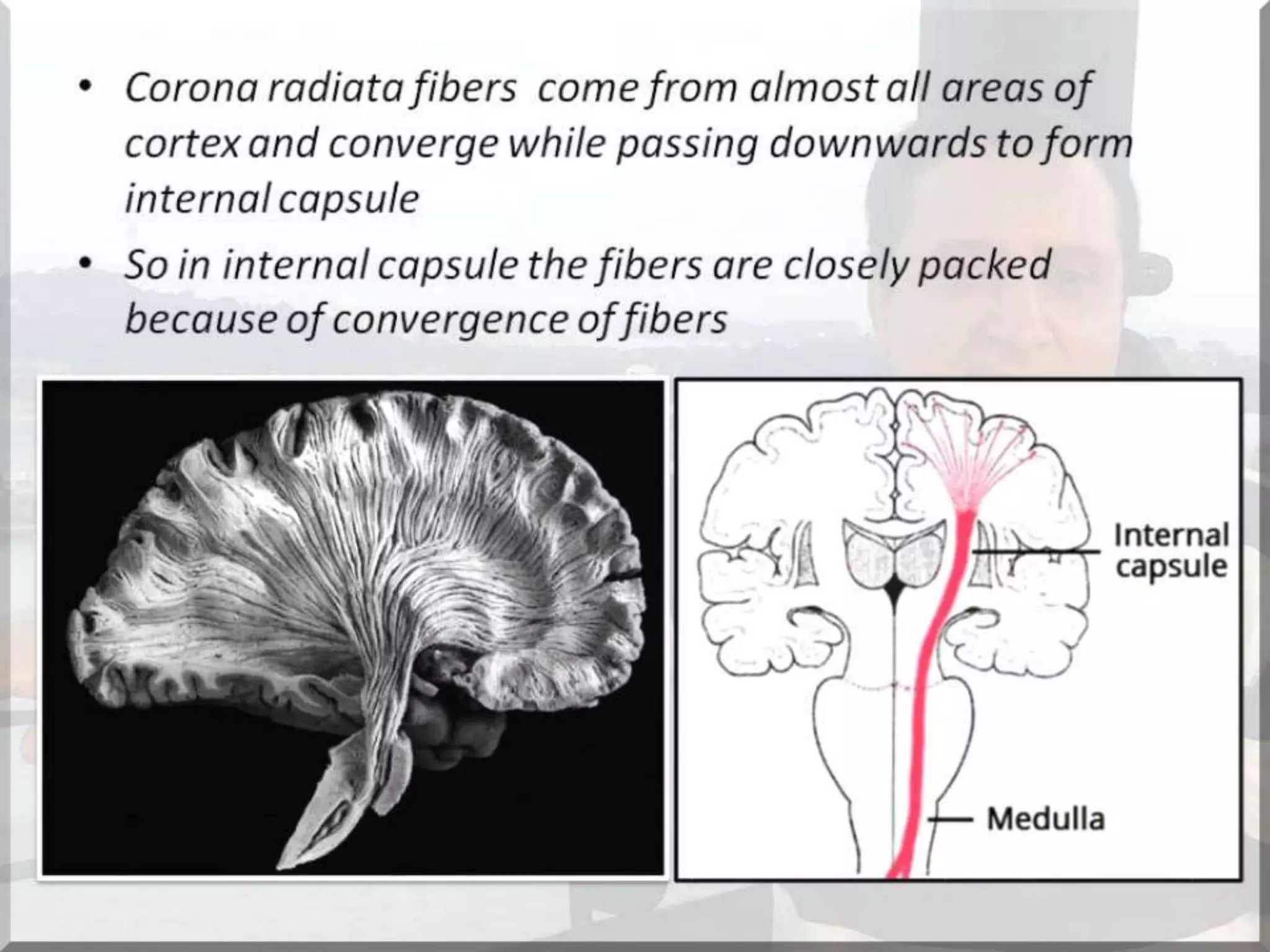 Localization of brainstem lesion by Prof Dr Bashir Ahmed Dar Sopore Kashmir