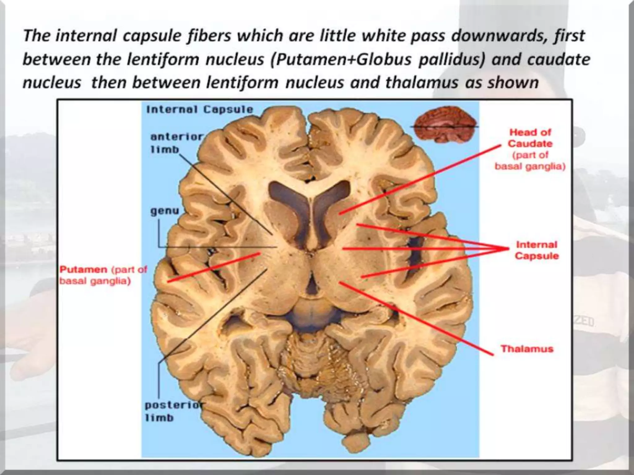 Localization of brainstem lesion by Prof Dr Bashir Ahmed Dar Sopore Kashmir