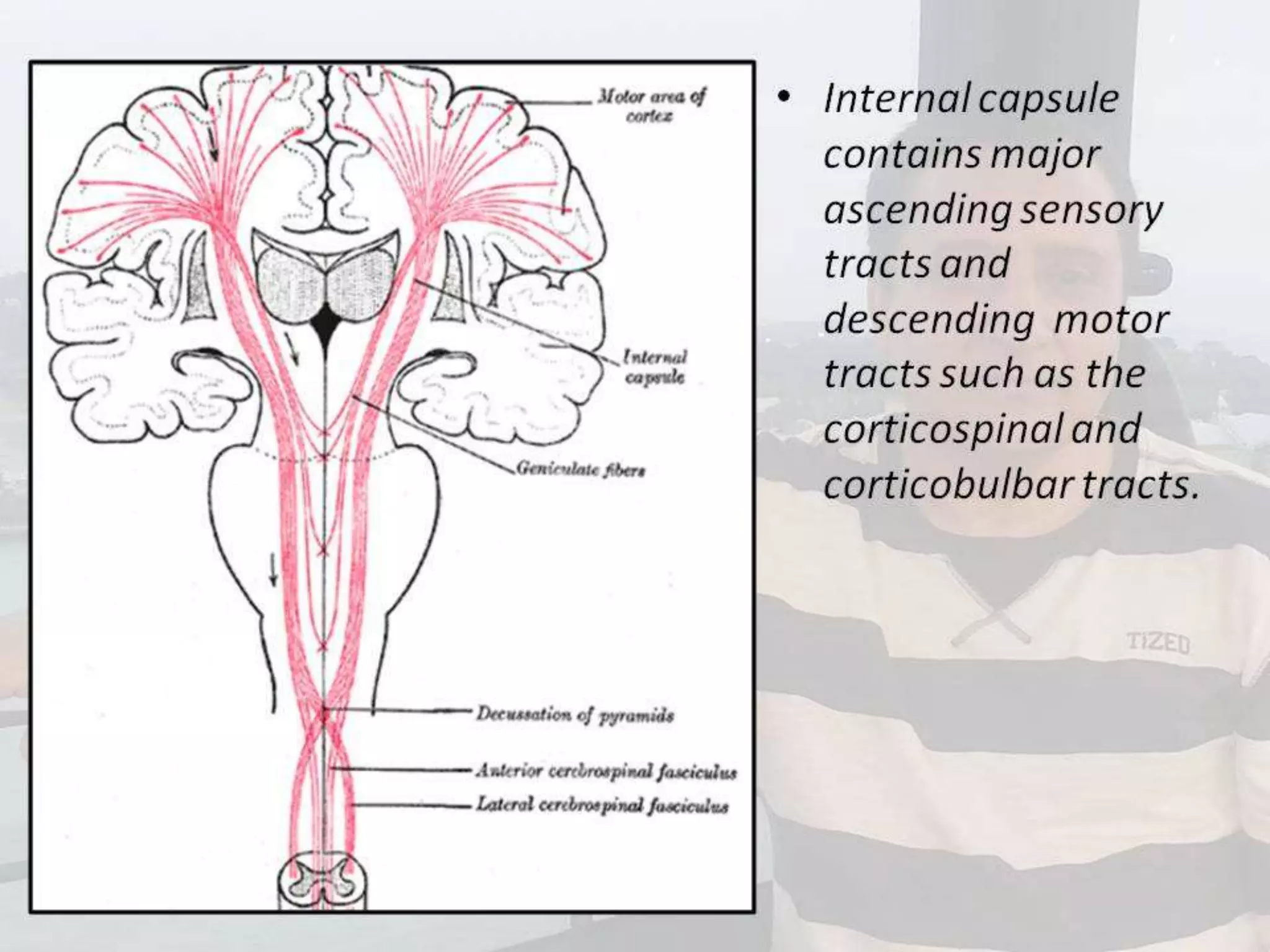 Localization of brainstem lesion by Prof Dr Bashir Ahmed Dar Sopore Kashmir