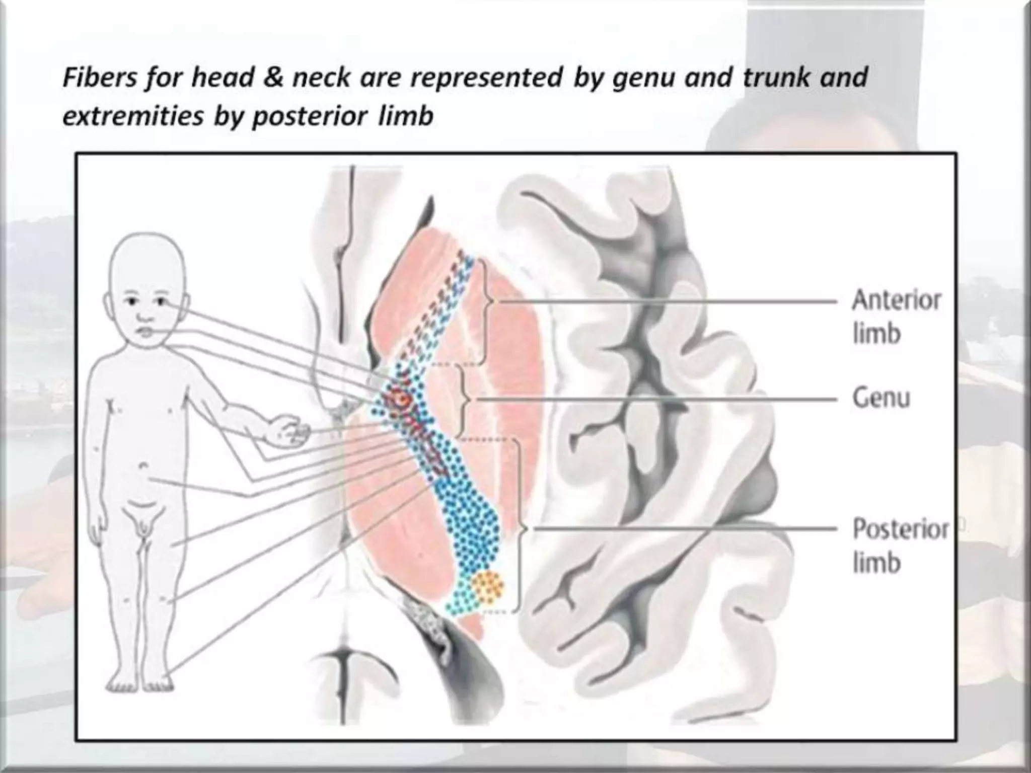 Localization of brainstem lesion by Prof Dr Bashir Ahmed Dar Sopore Kashmir