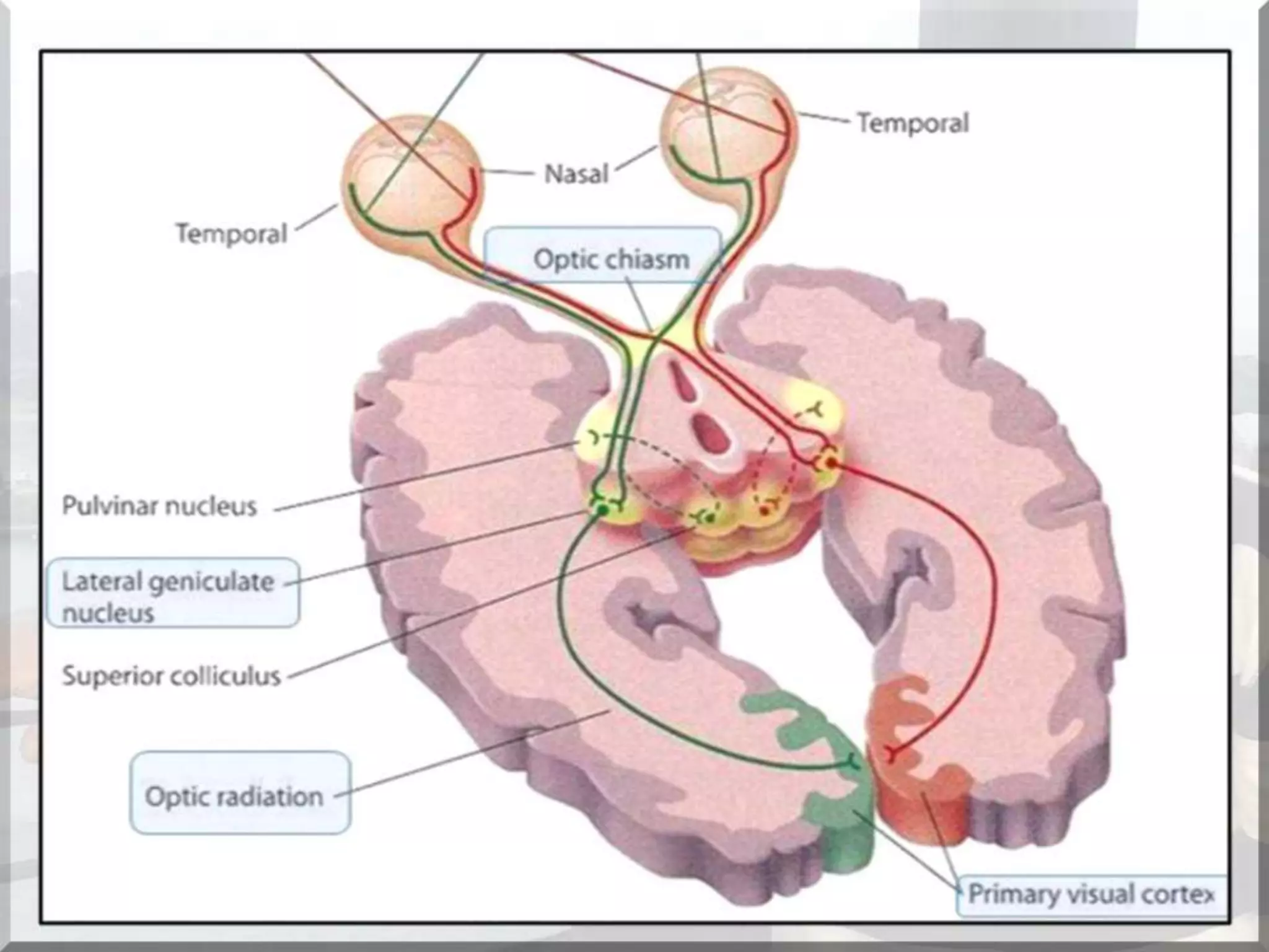 Localization of brainstem lesion by Prof Dr Bashir Ahmed Dar Sopore Kashmir