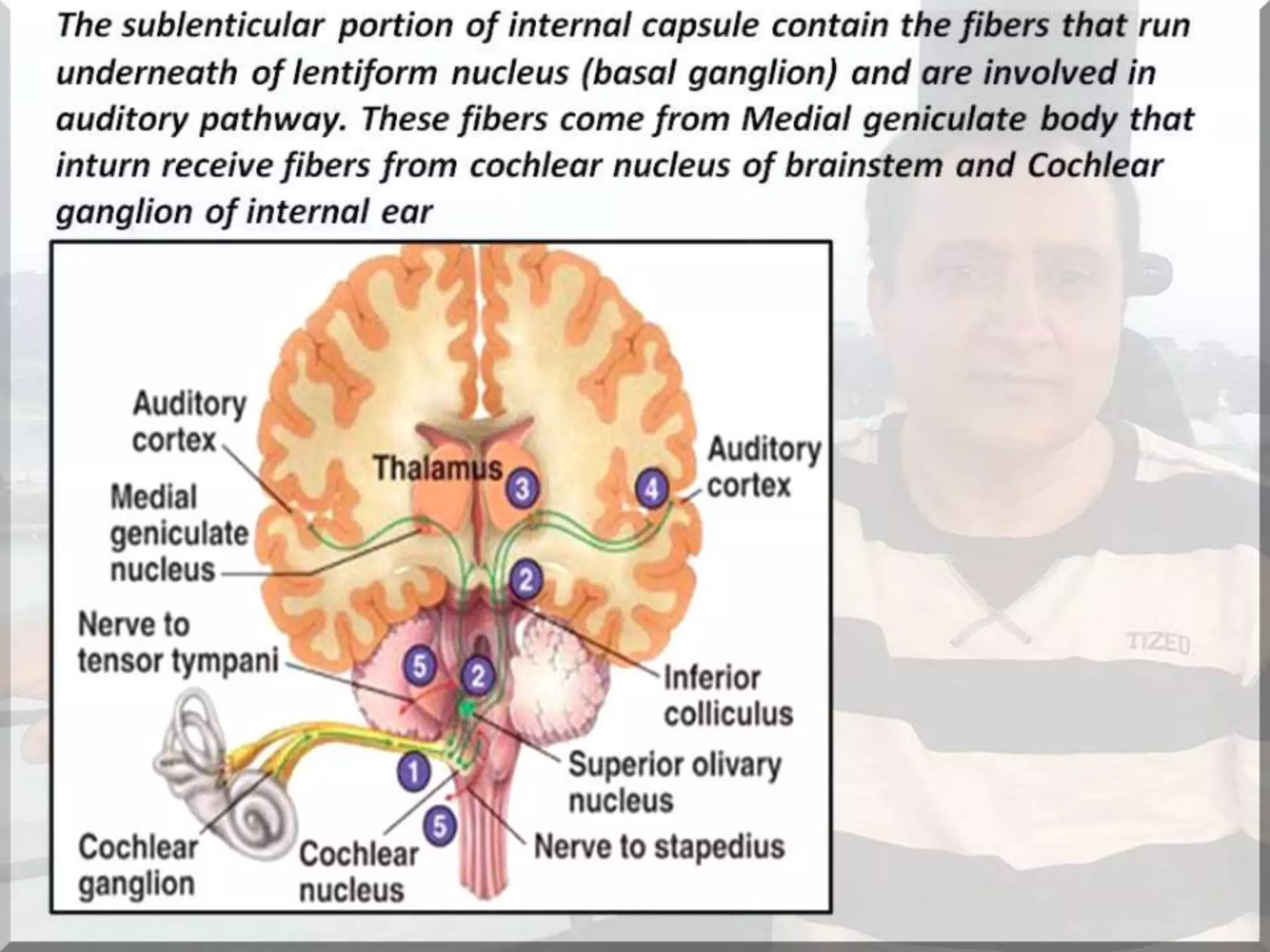 Localization of brainstem lesion by Prof Dr Bashir Ahmed Dar Sopore Kashmir