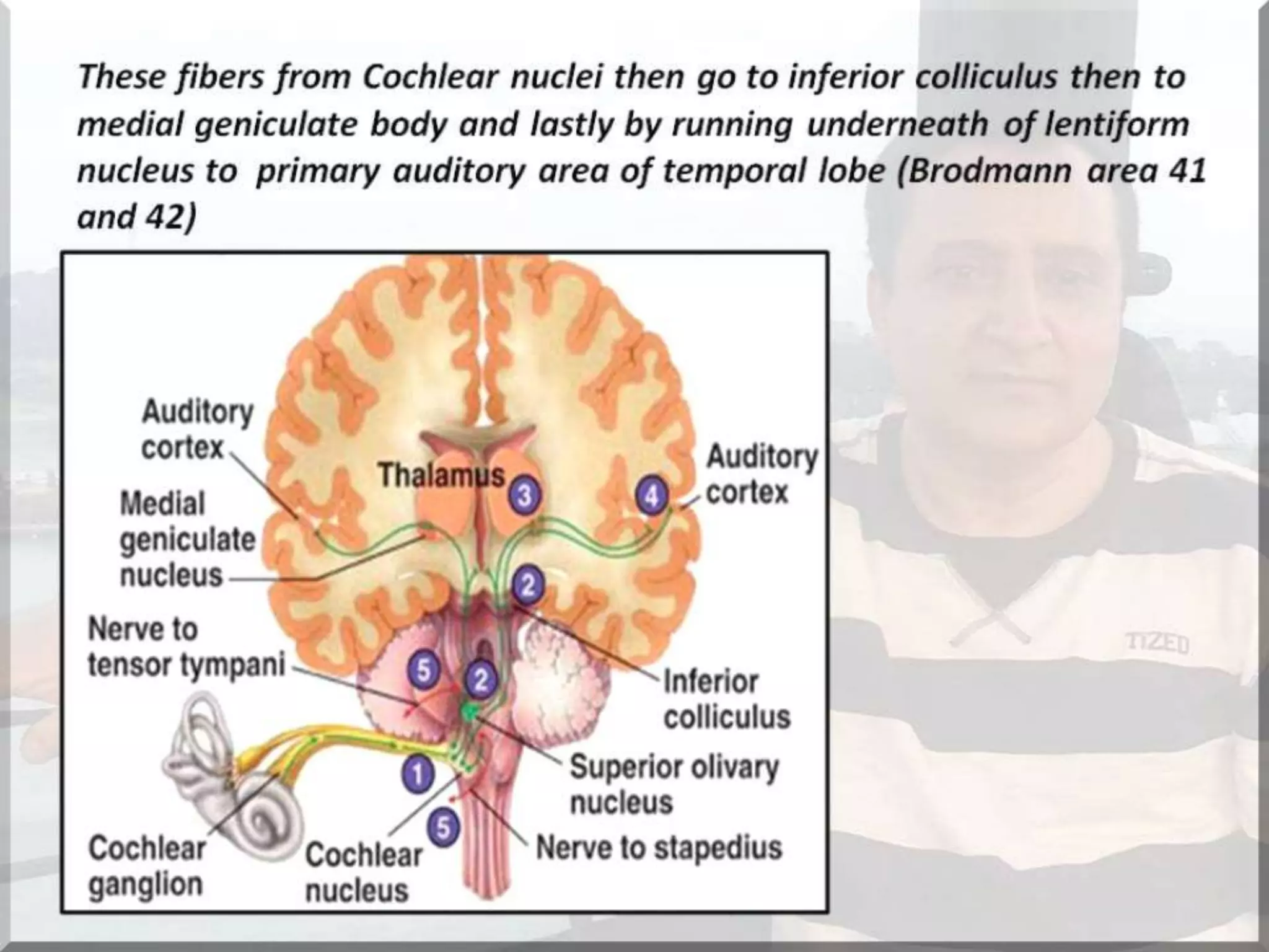 Localization of brainstem lesion by Prof Dr Bashir Ahmed Dar Sopore Kashmir