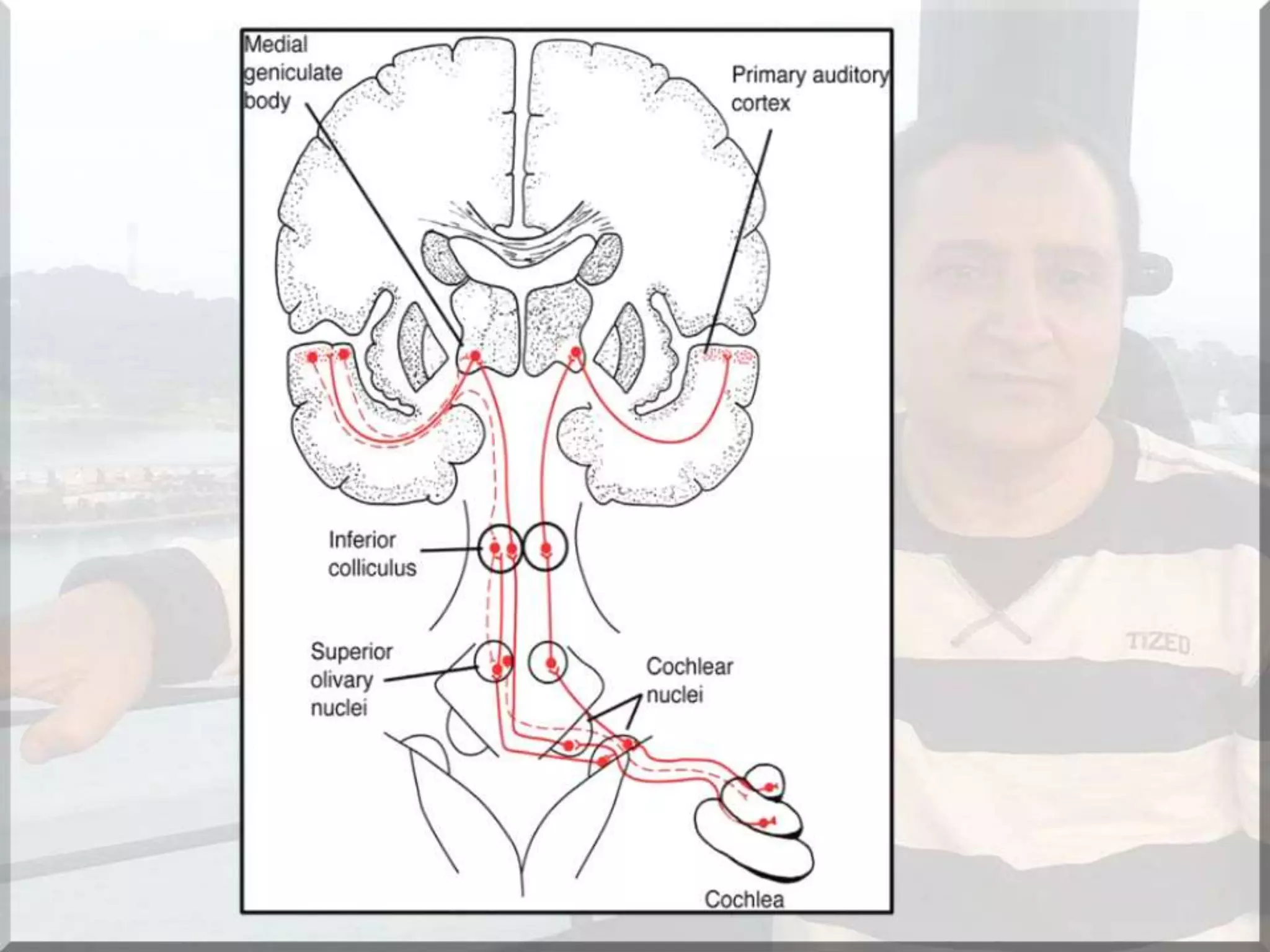 Localization of brainstem lesion by Prof Dr Bashir Ahmed Dar Sopore Kashmir