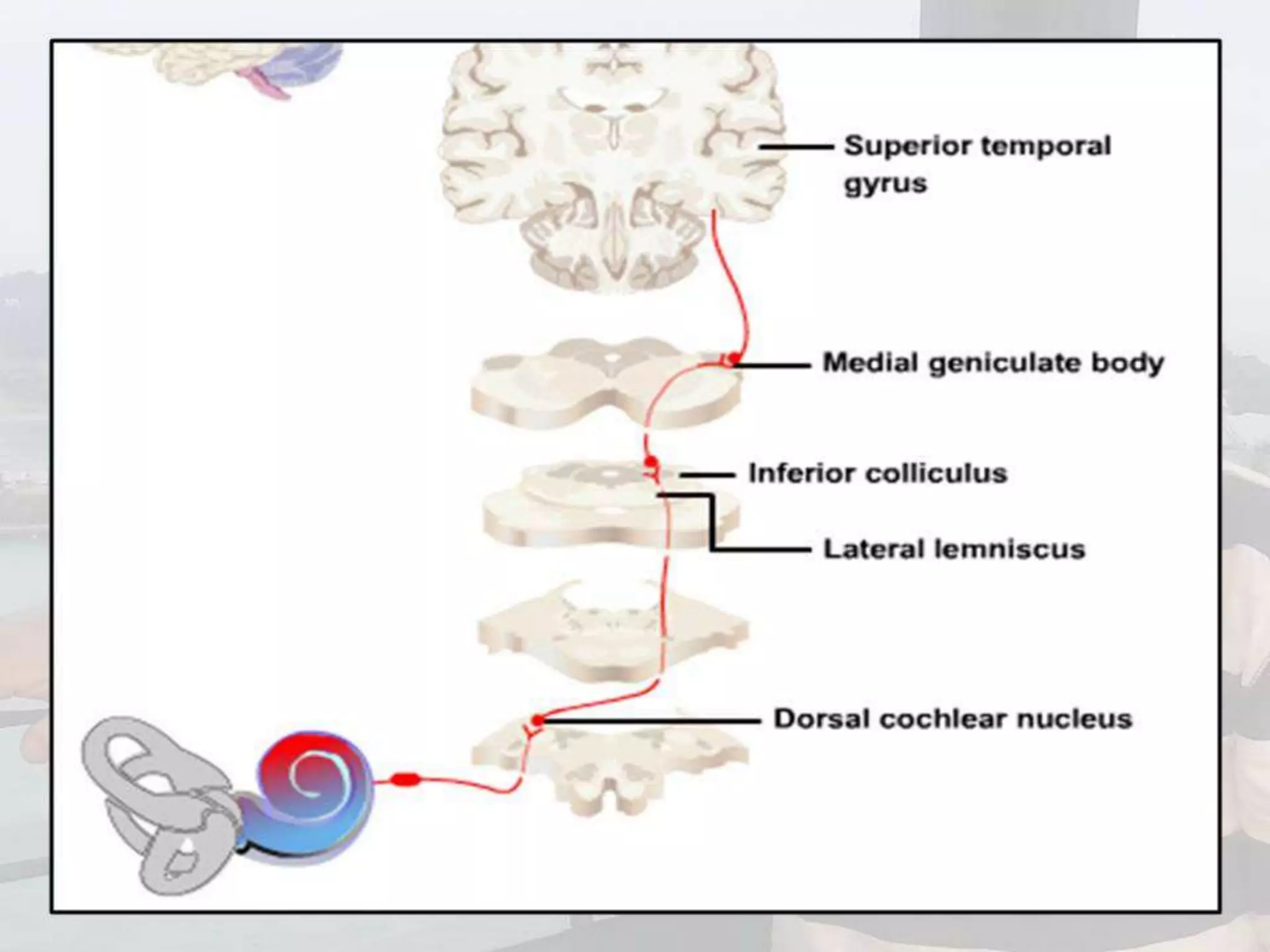 Localization of brainstem lesion by Prof Dr Bashir Ahmed Dar Sopore Kashmir