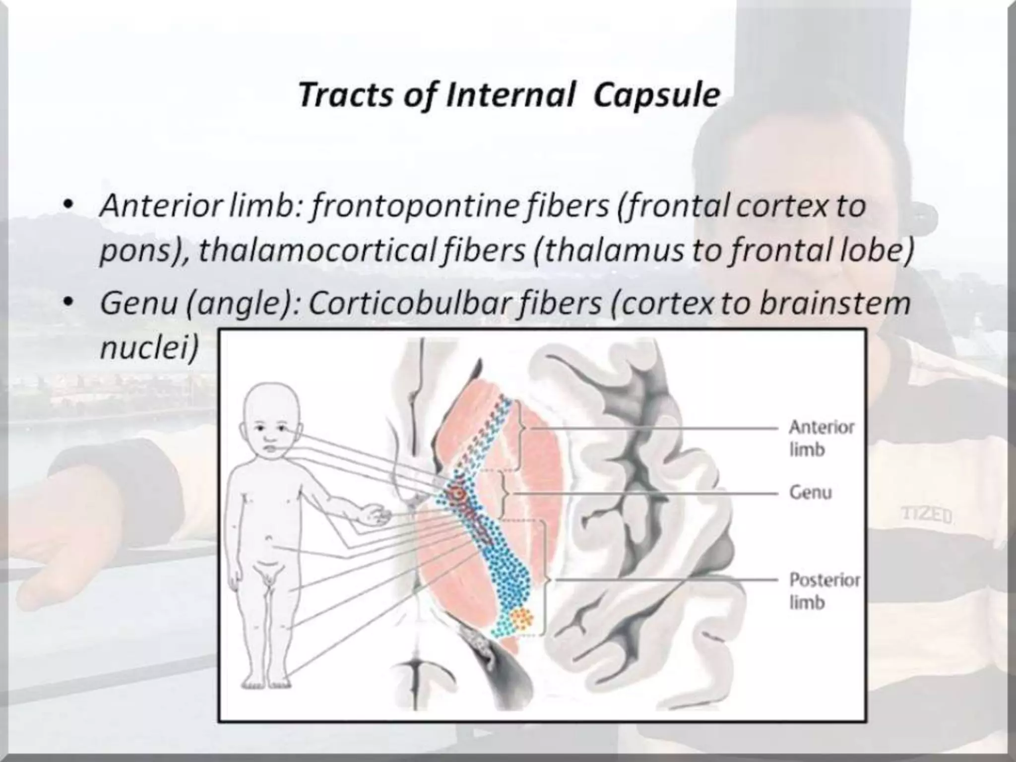 Localization of brainstem lesion by Prof Dr Bashir Ahmed Dar Sopore Kashmir