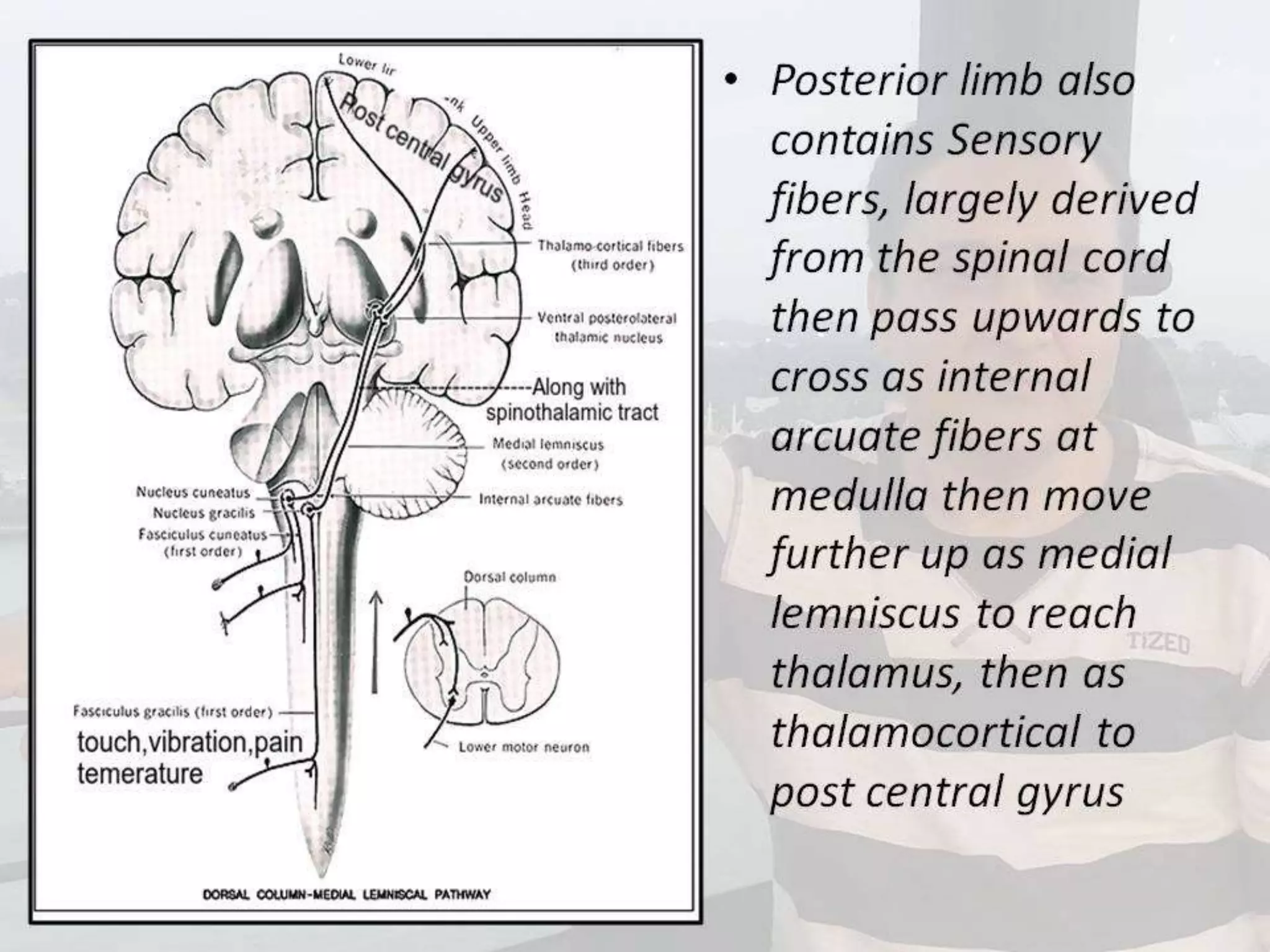 Localization of brainstem lesion by Prof Dr Bashir Ahmed Dar Sopore Kashmir