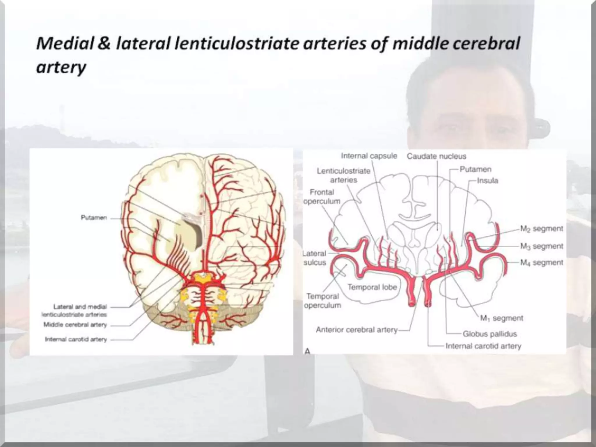 Localization of brainstem lesion by Prof Dr Bashir Ahmed Dar Sopore Kashmir