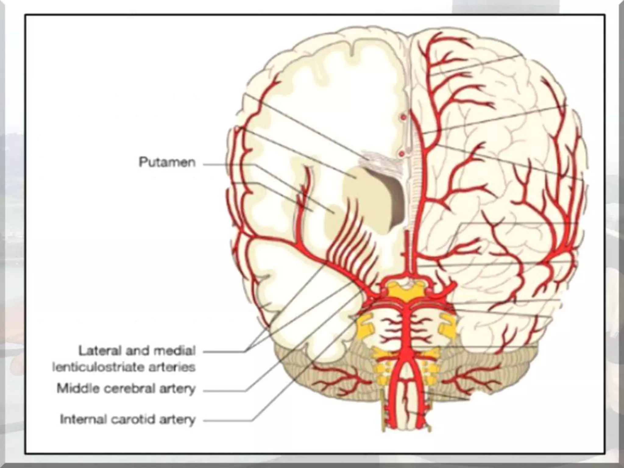 Localization of brainstem lesion by Prof Dr Bashir Ahmed Dar Sopore Kashmir