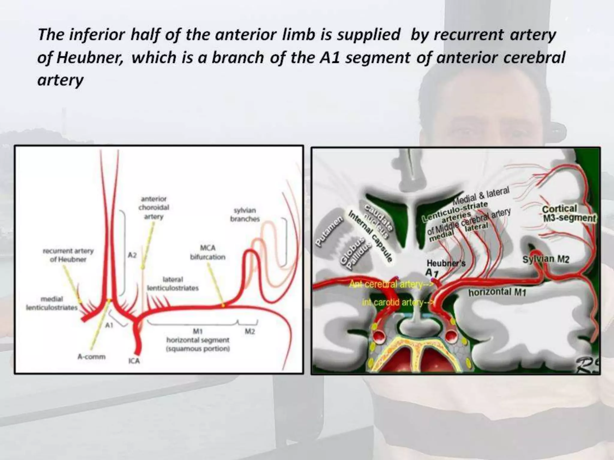 Localization of brainstem lesion by Prof Dr Bashir Ahmed Dar Sopore Kashmir