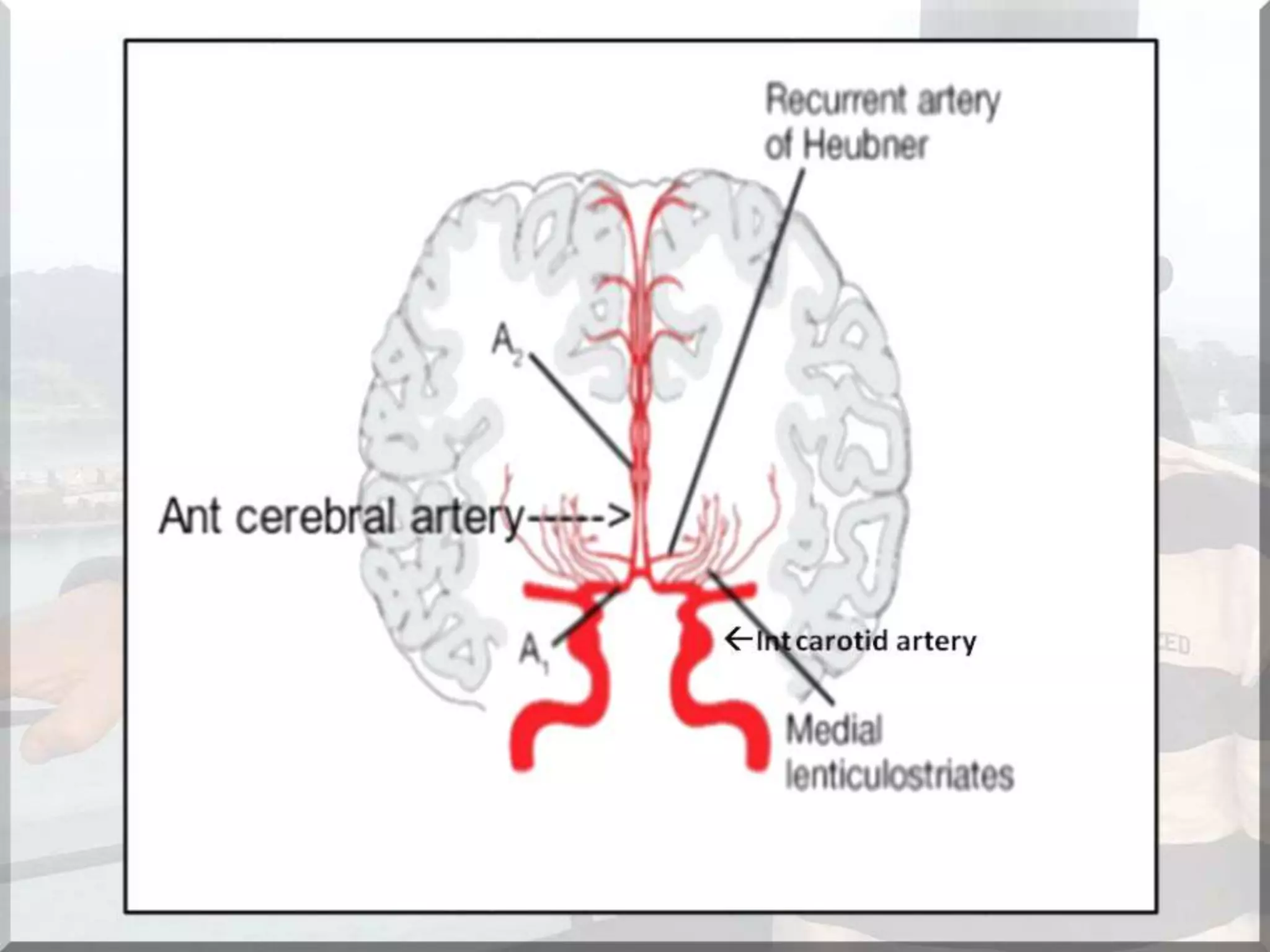 Localization of brainstem lesion by Prof Dr Bashir Ahmed Dar Sopore Kashmir