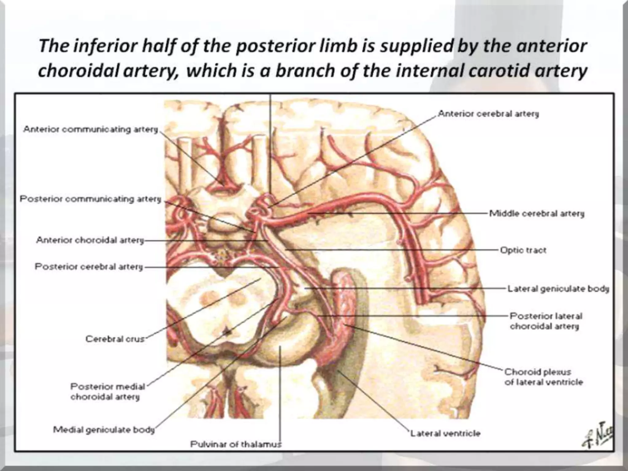 Localization of brainstem lesion by Prof Dr Bashir Ahmed Dar Sopore Kashmir