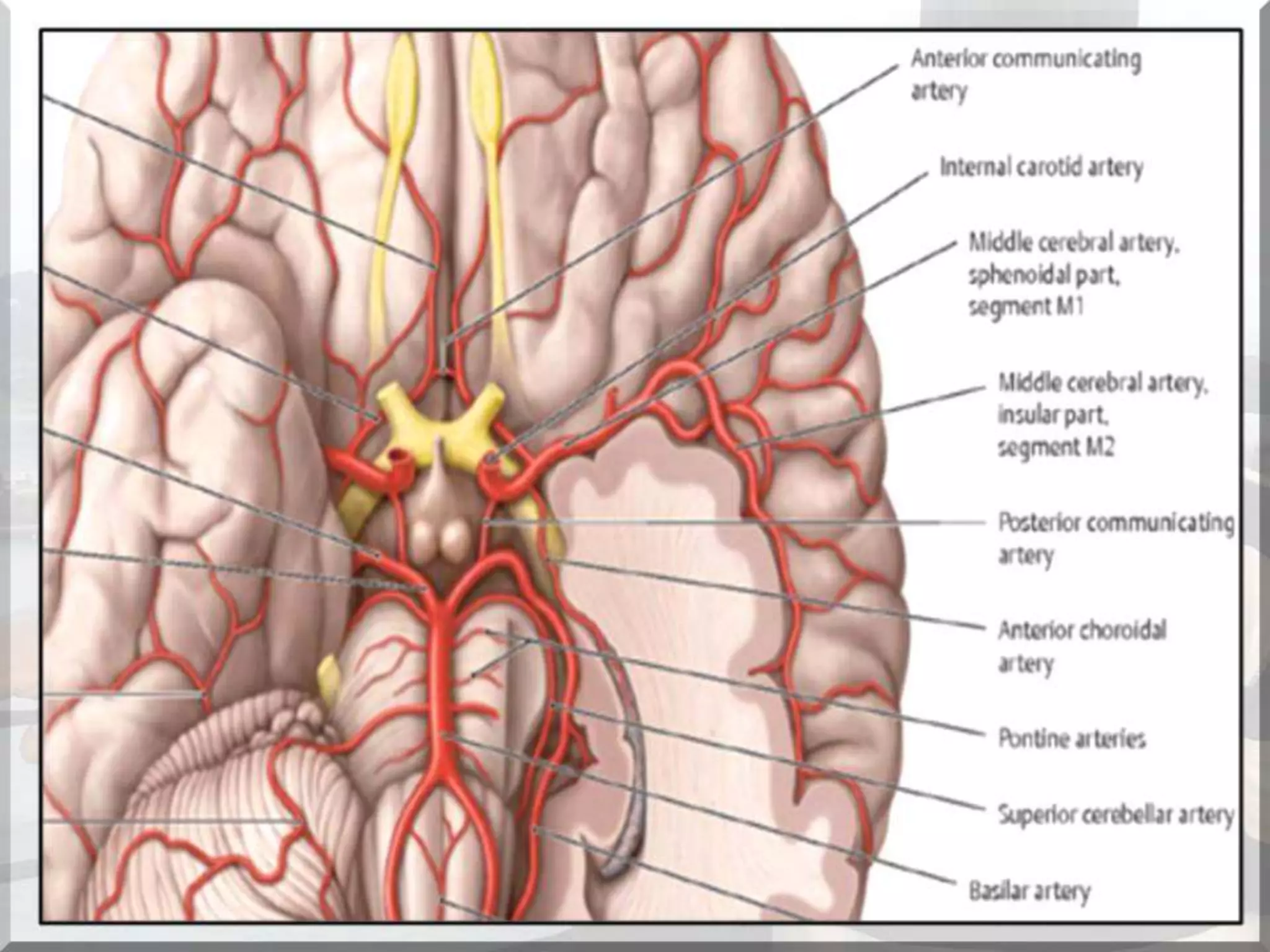 Localization of brainstem lesion by Prof Dr Bashir Ahmed Dar Sopore Kashmir