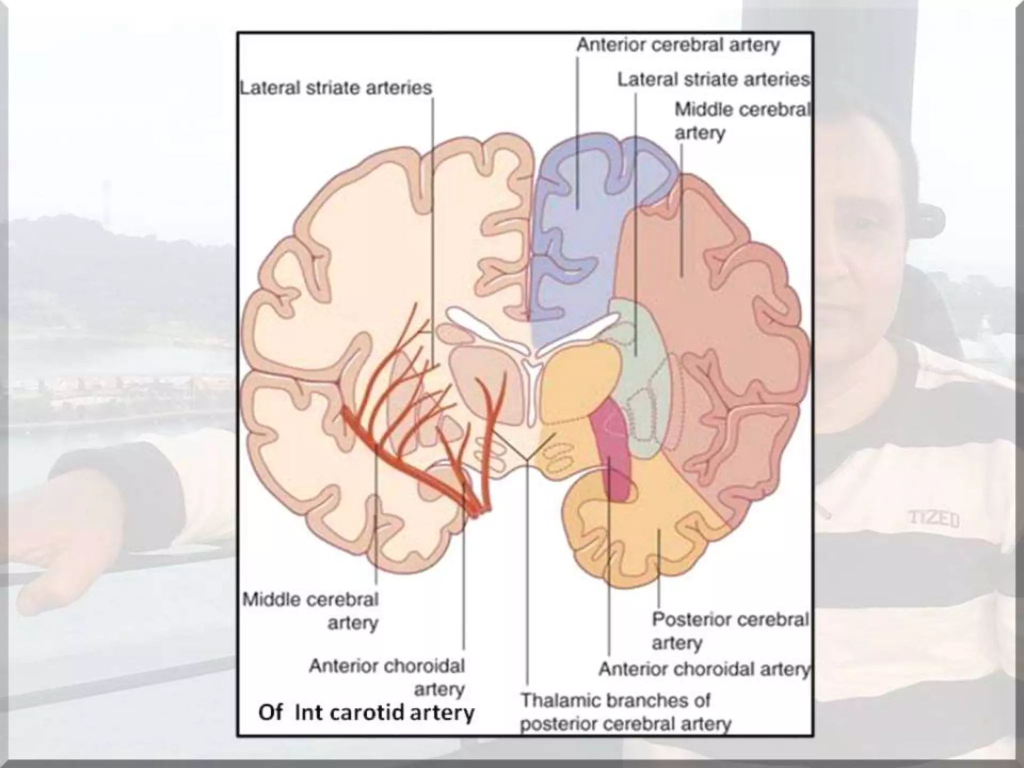 Localization of brainstem lesion by Prof Dr Bashir Ahmed Dar Sopore Kashmir