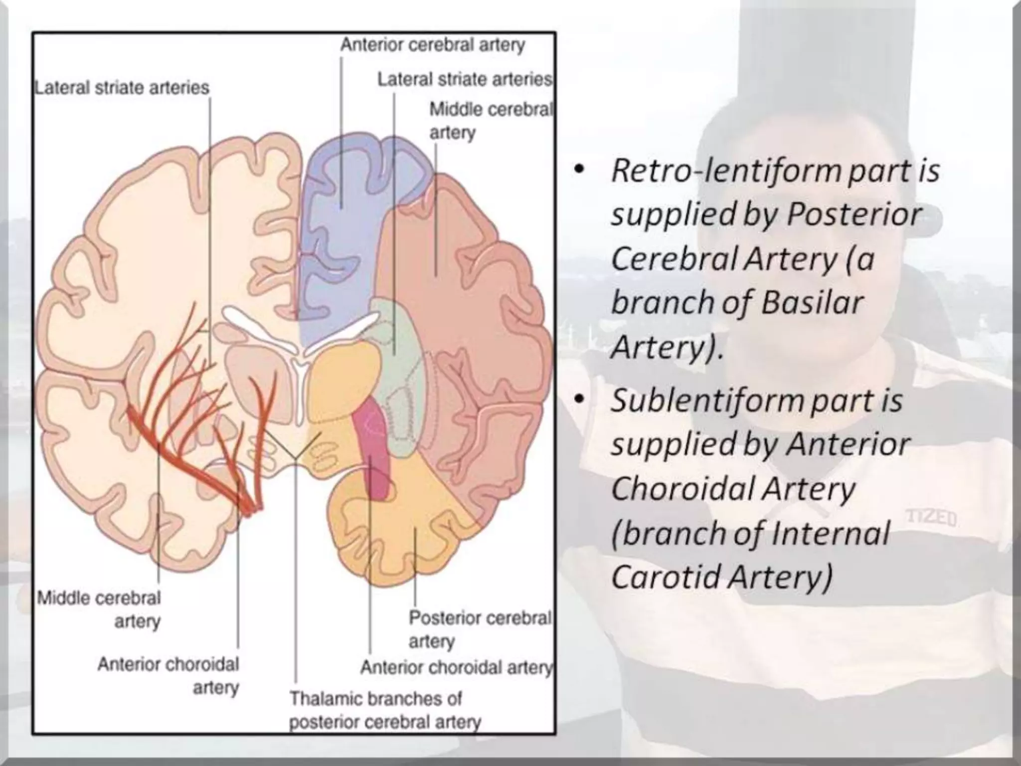 Localization of brainstem lesion by Prof Dr Bashir Ahmed Dar Sopore Kashmir
