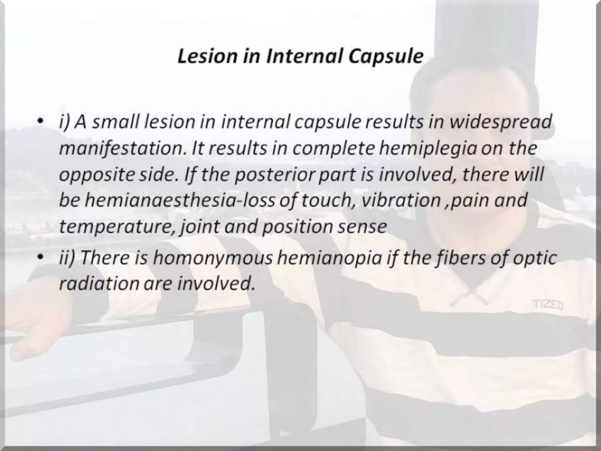Localization of brainstem lesion by Prof Dr Bashir Ahmed Dar Sopore Kashmir
