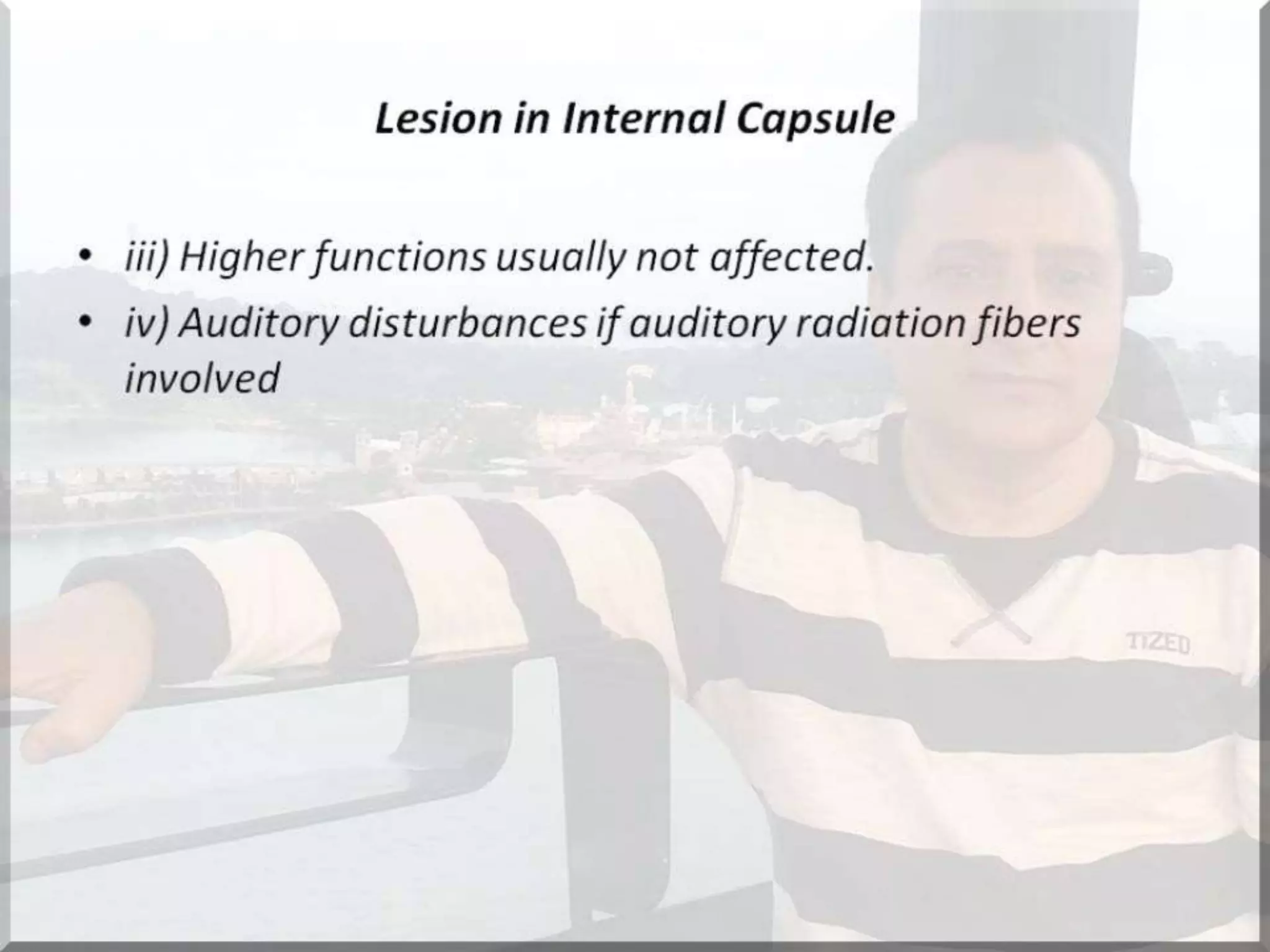 Localization of brainstem lesion by Prof Dr Bashir Ahmed Dar Sopore Kashmir